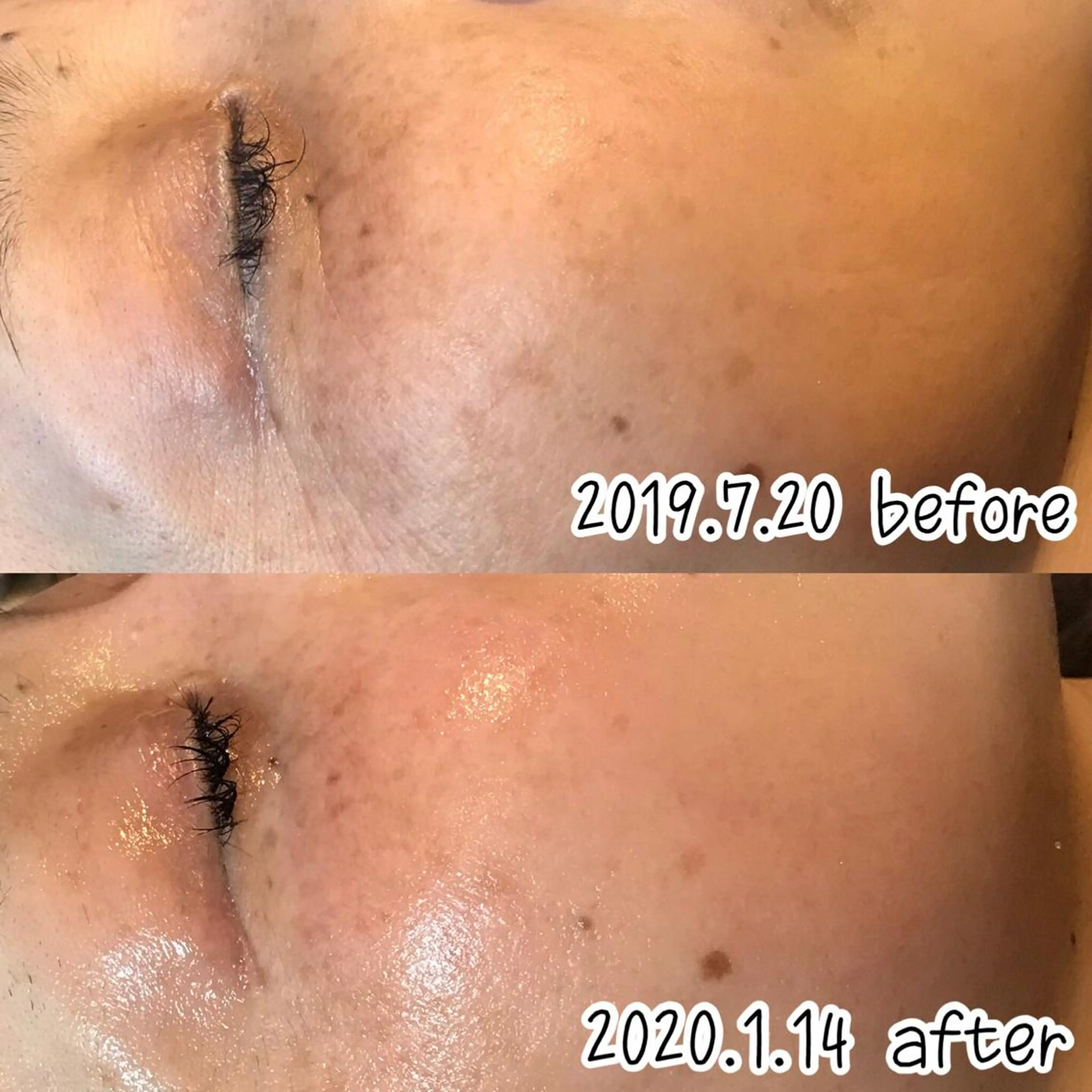 エステ 浜野 恵美のエステ・リラクイメージ