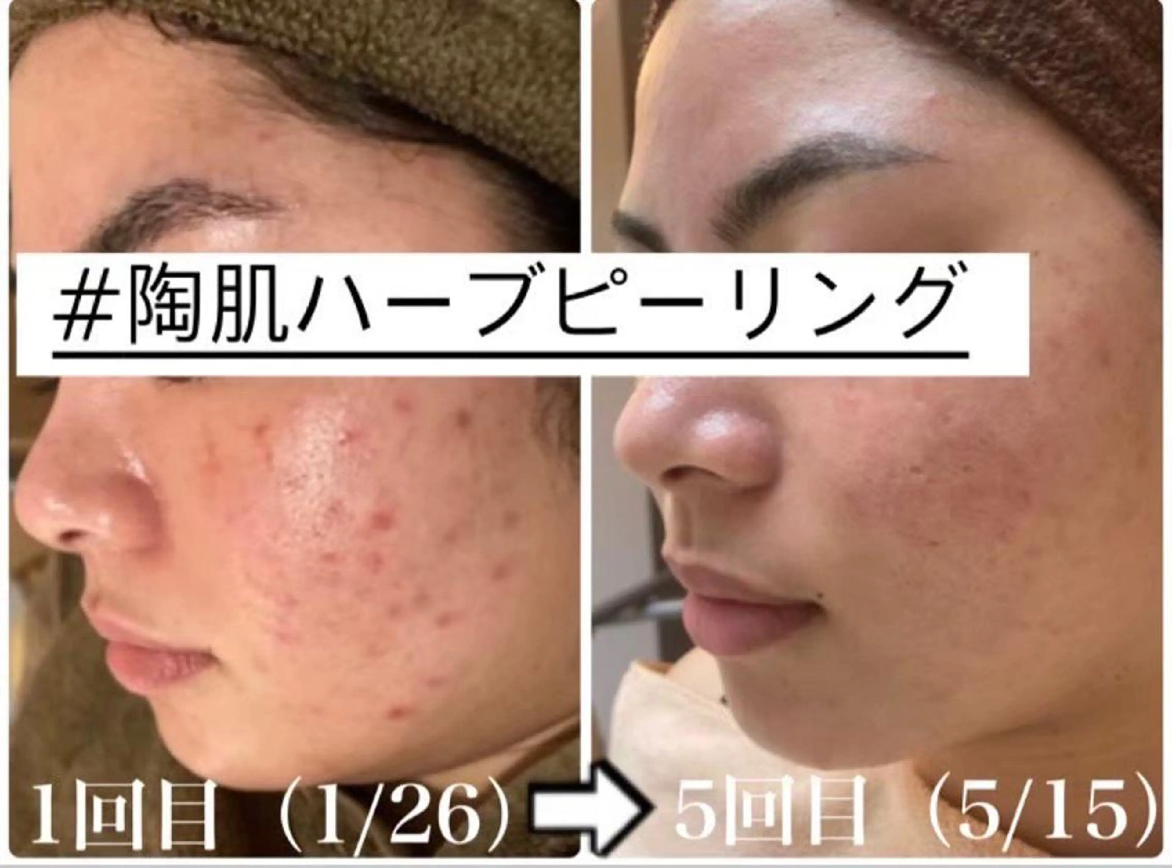 hm NATURESKINのエステ・リラクイメージ