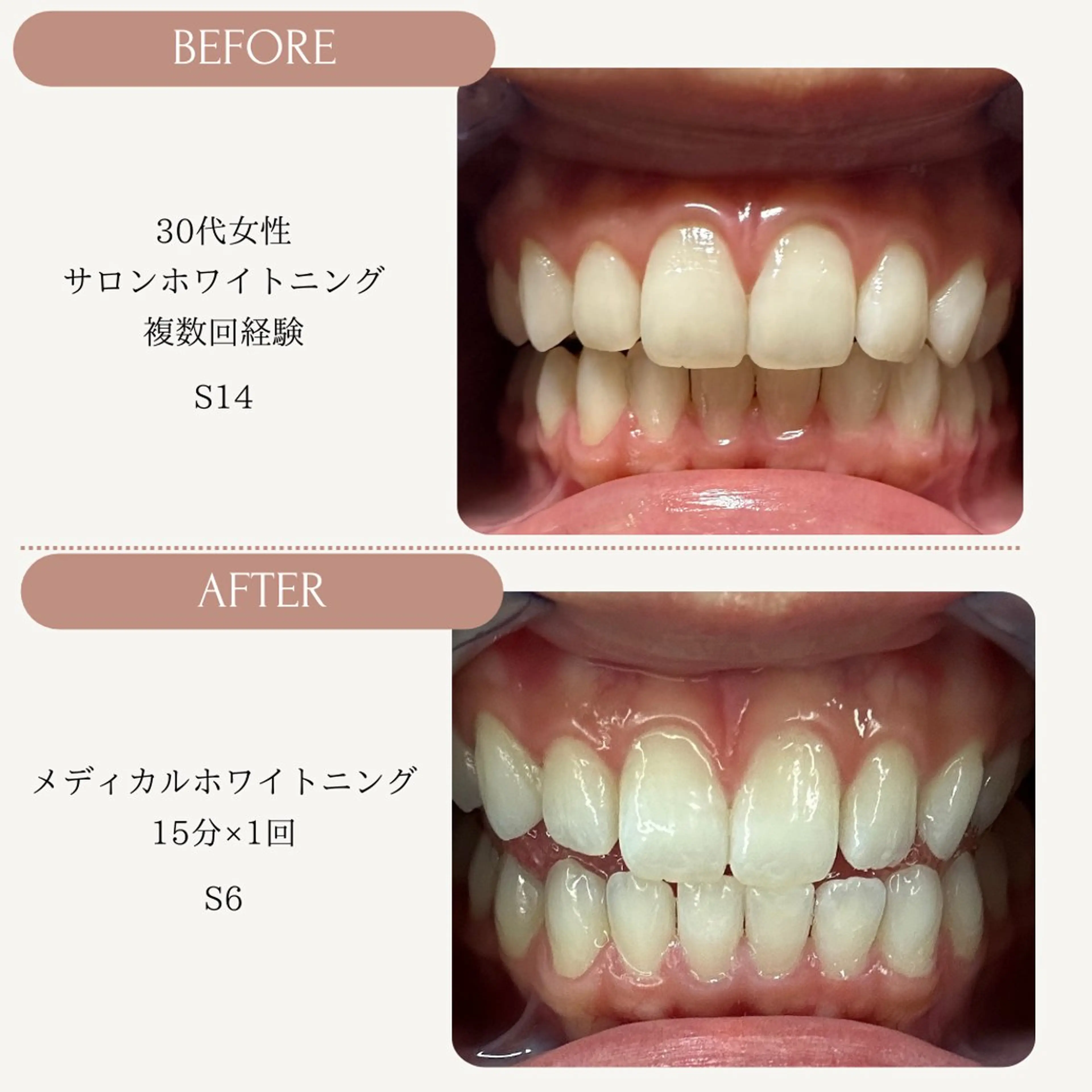 Whitening Carat 恵比寿店所属・ホワイトニング カラット 恵比寿店のエステ・リラクイメージ