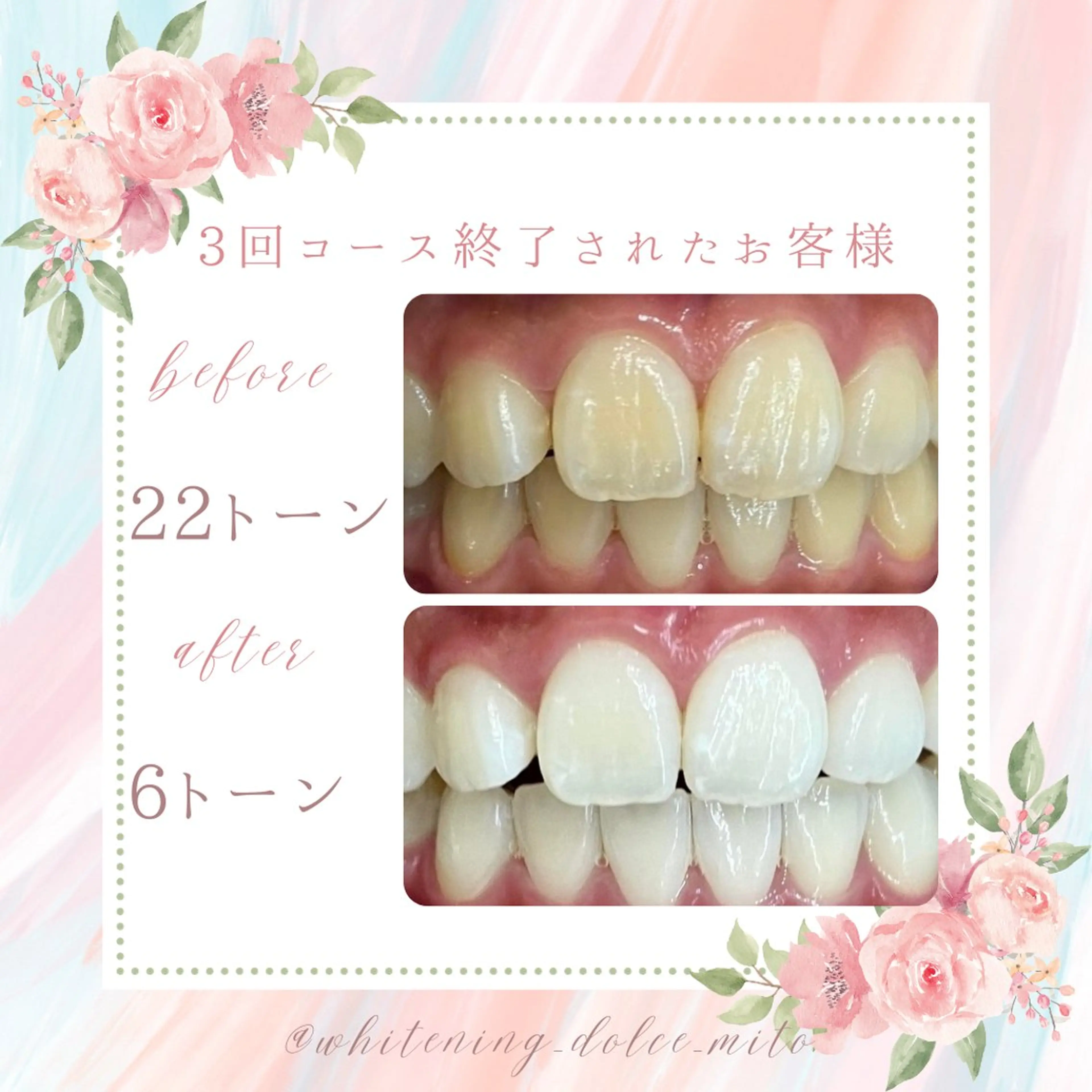 その他 セルフホワイトニング Dolce水戸店のその他イメージ