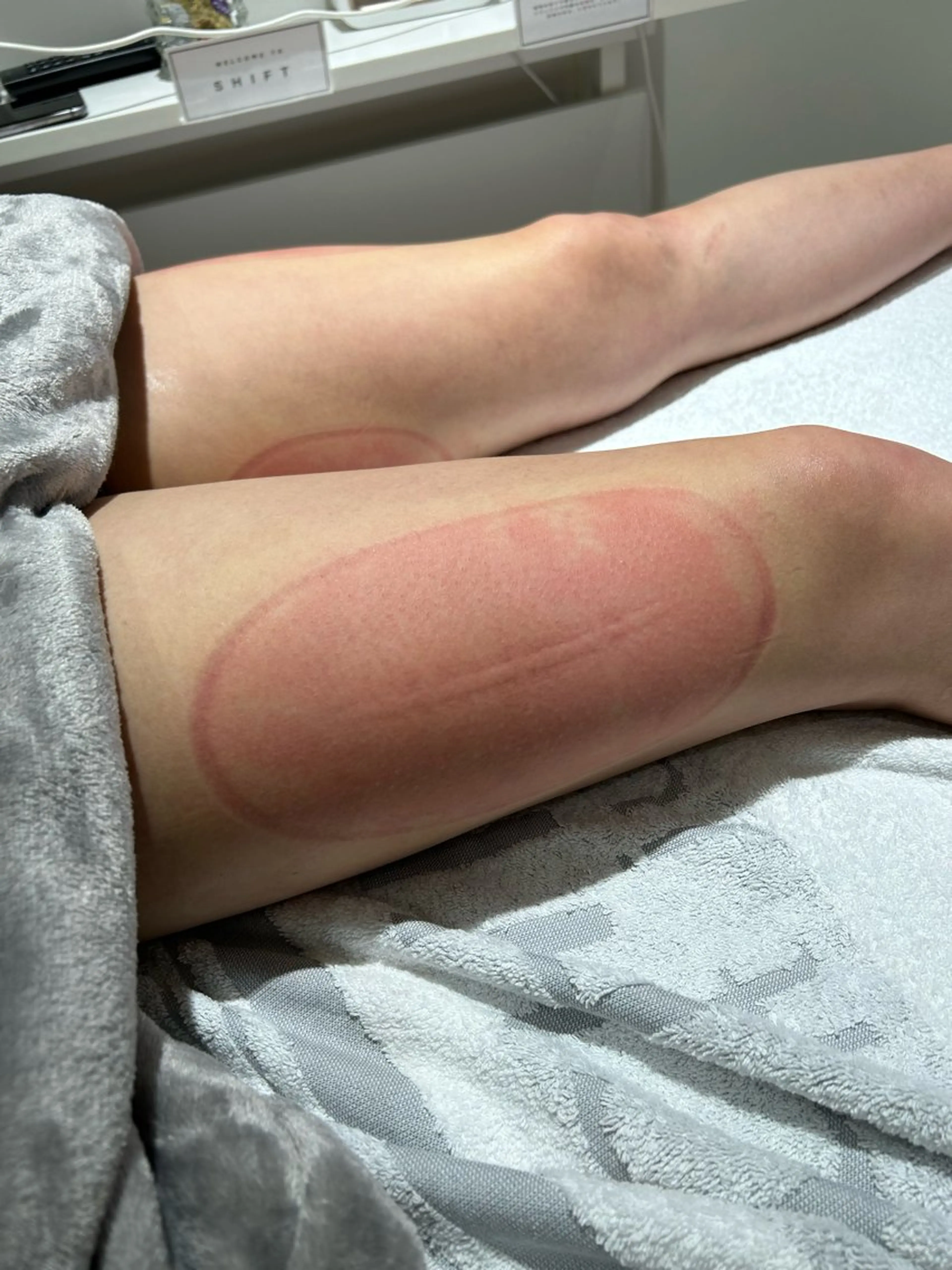 脂肪冷却痩身サロン SHIFT 東京のエステ・リラクイメージ