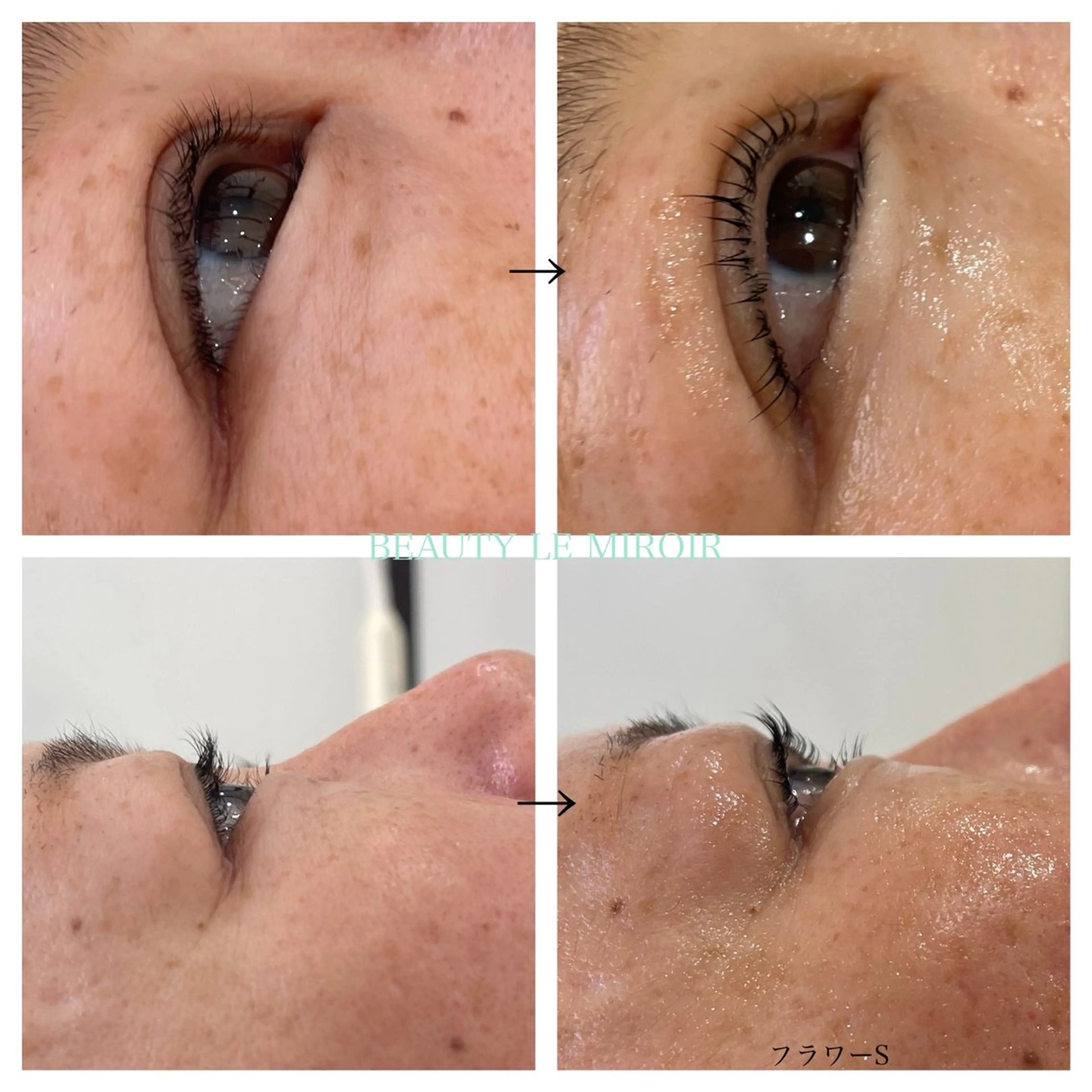 マツエク・マツパ ビューティー ミロワールのエステ・リラクイメージ