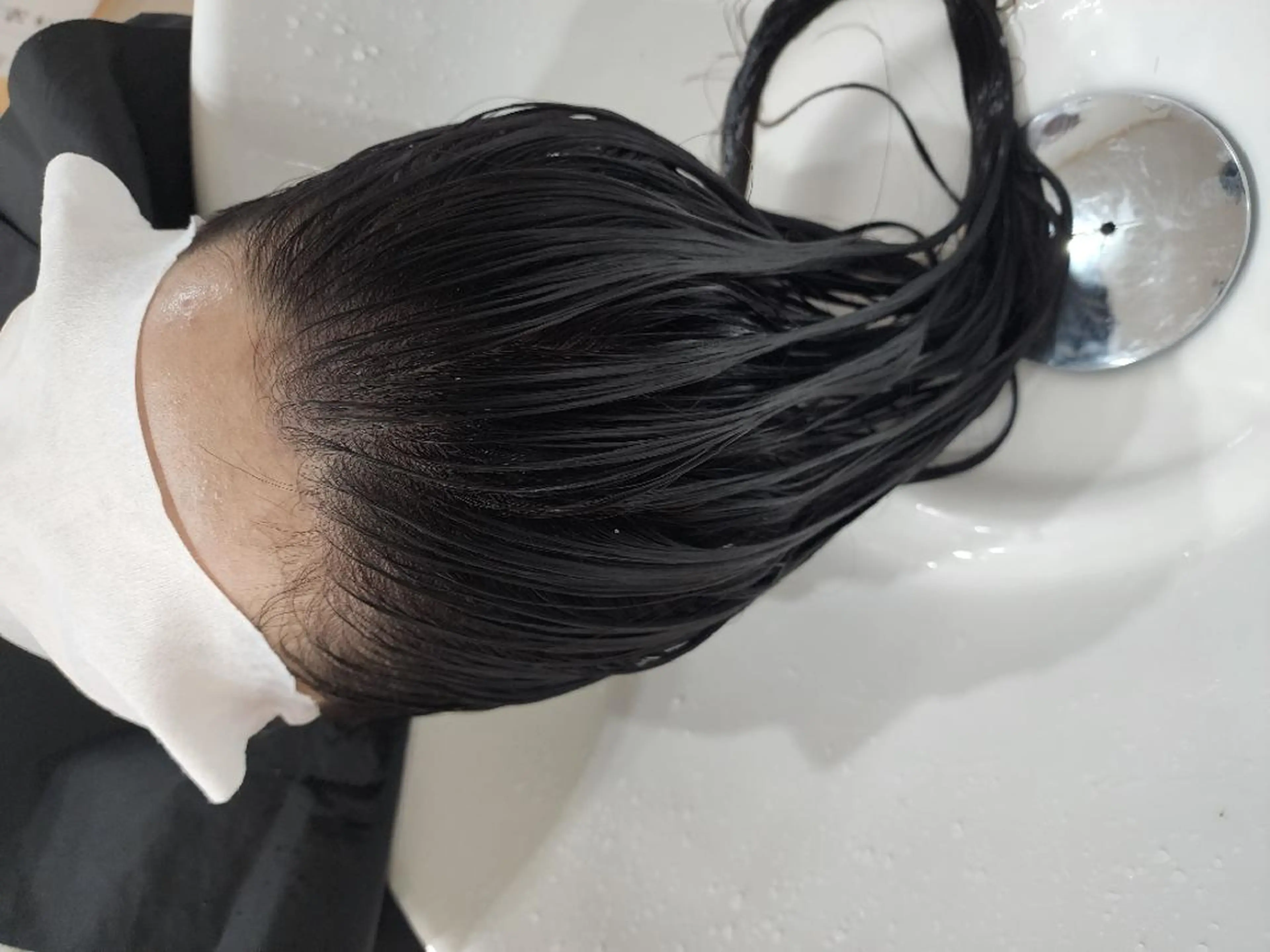 集中トリートメントの写真