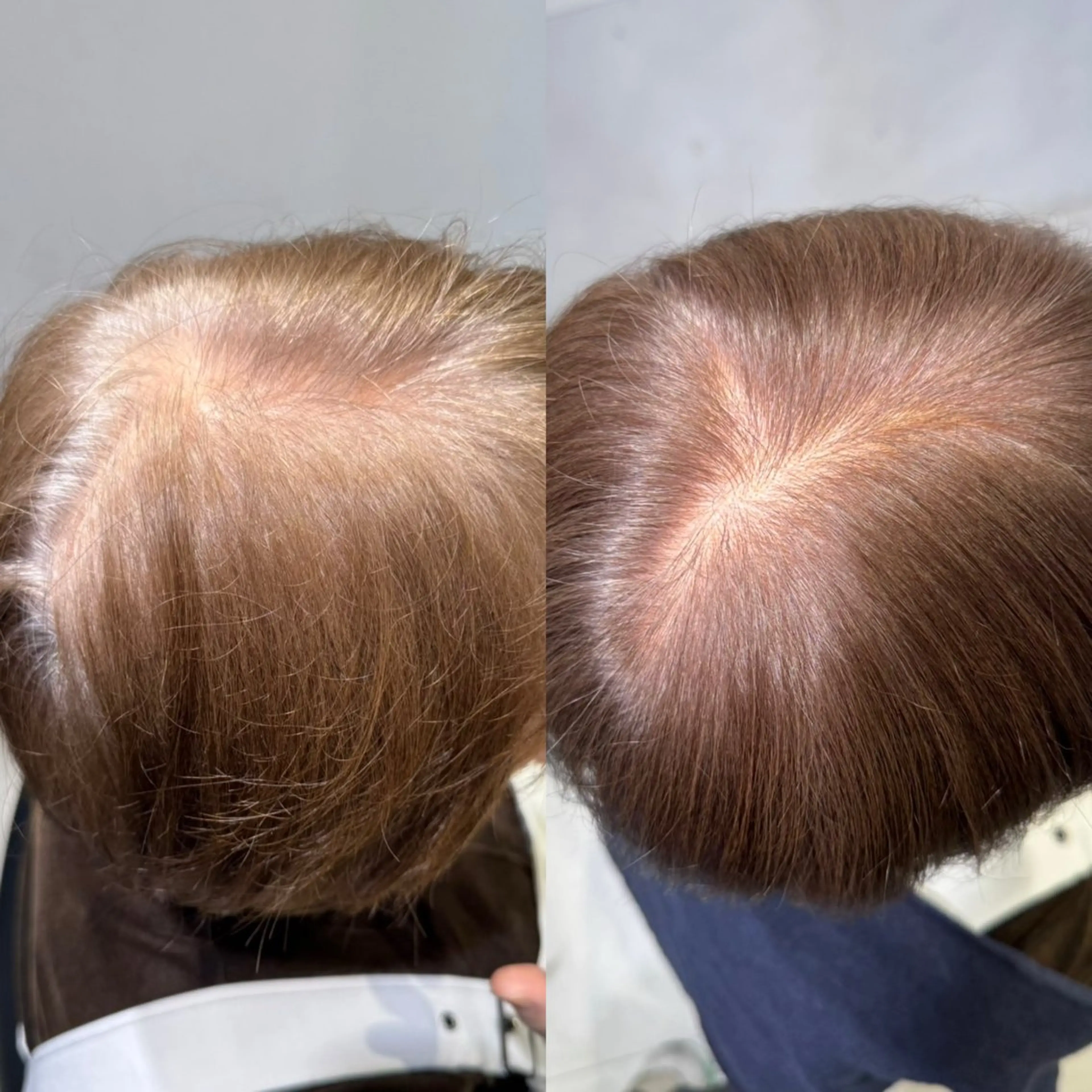 【一ヶ月以内でご来店の方⏰根本のメンテナンス🔨】脱白髪染めイルミナ系リタッチカラー+選べる5stepトリートメント🌟の写真