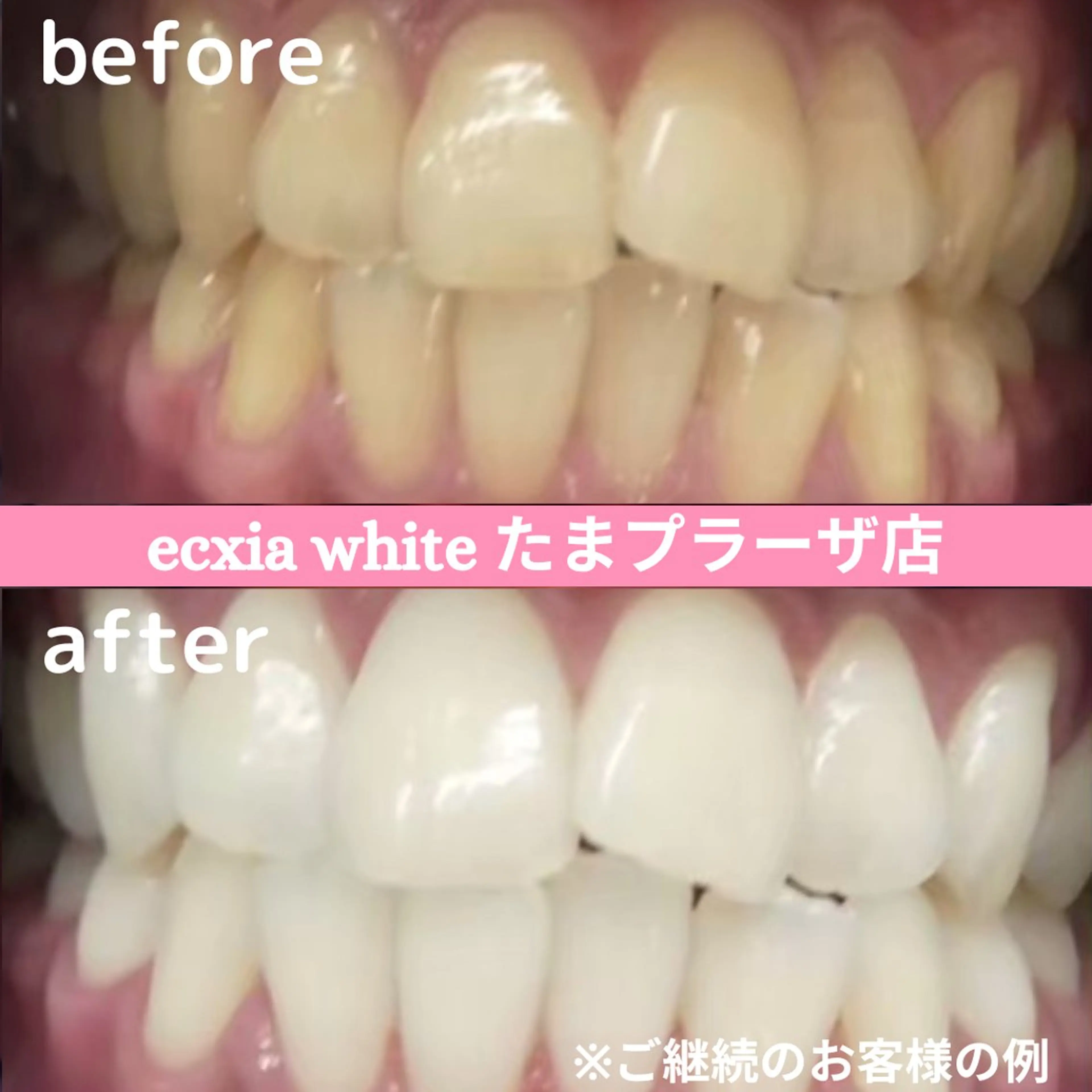 その他 セルフホワイトニング　エクシアたまプラーザ店所属・セルフホワイトニング エクシアたまプラーザのその他イメージ