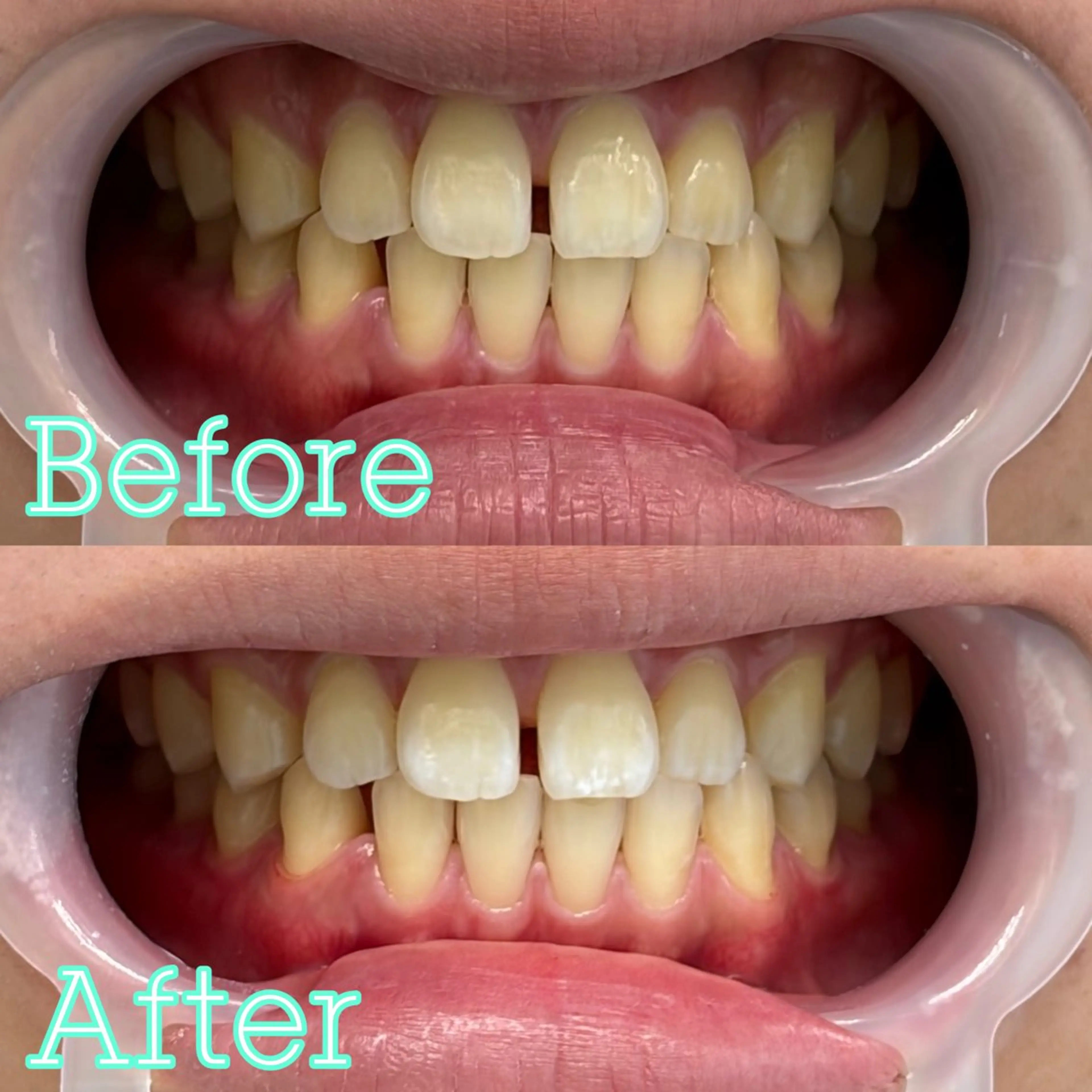 歯のホワイトニング専門店 MIGAQ 京都四条大宮店所属・佐藤 未来の眉毛・アイブロウイメージ