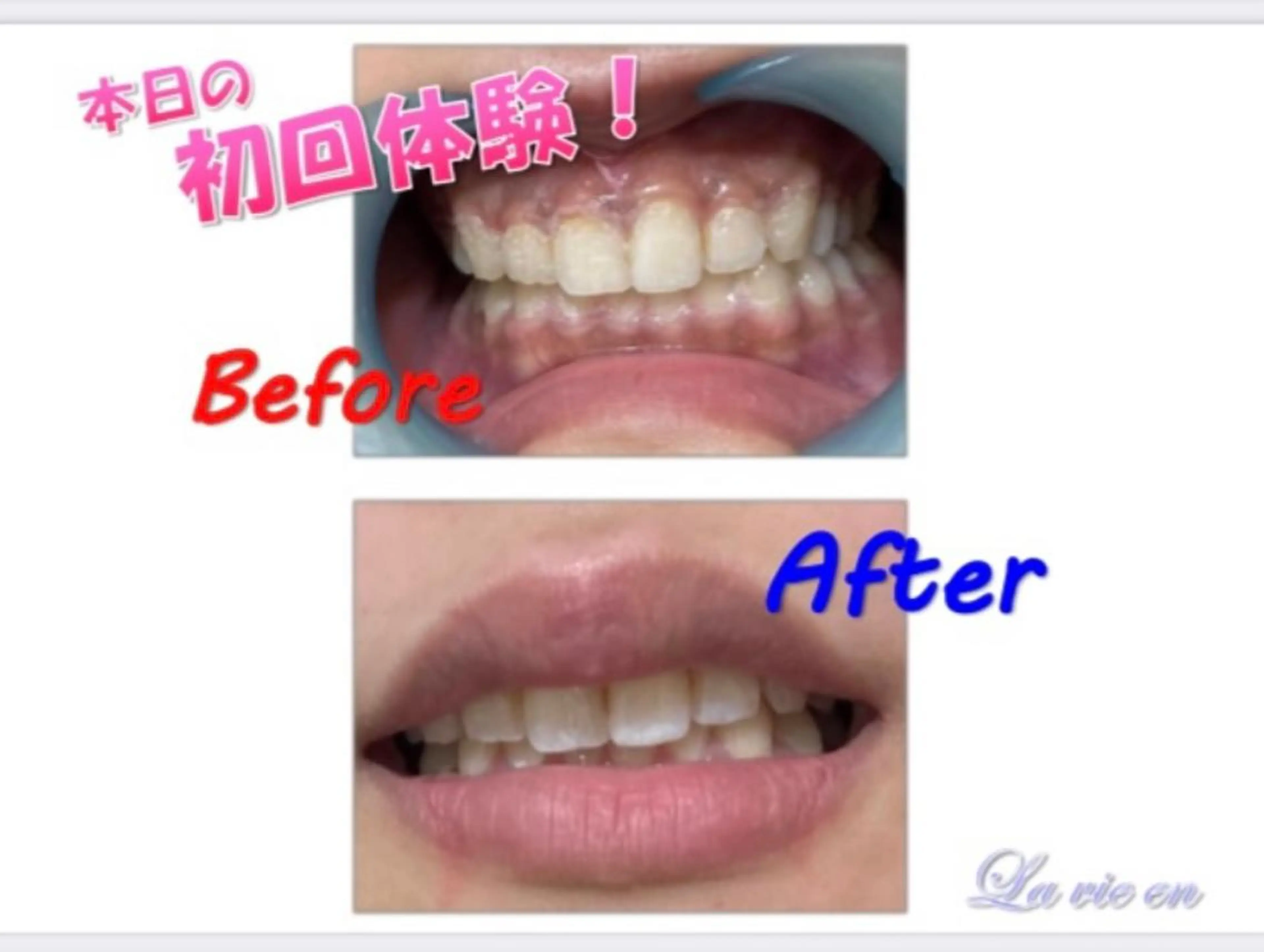 その他 セルフホワイトニングサロン　ラヴィアン所属・ホワイトニングサロン La vie enのその他イメージ