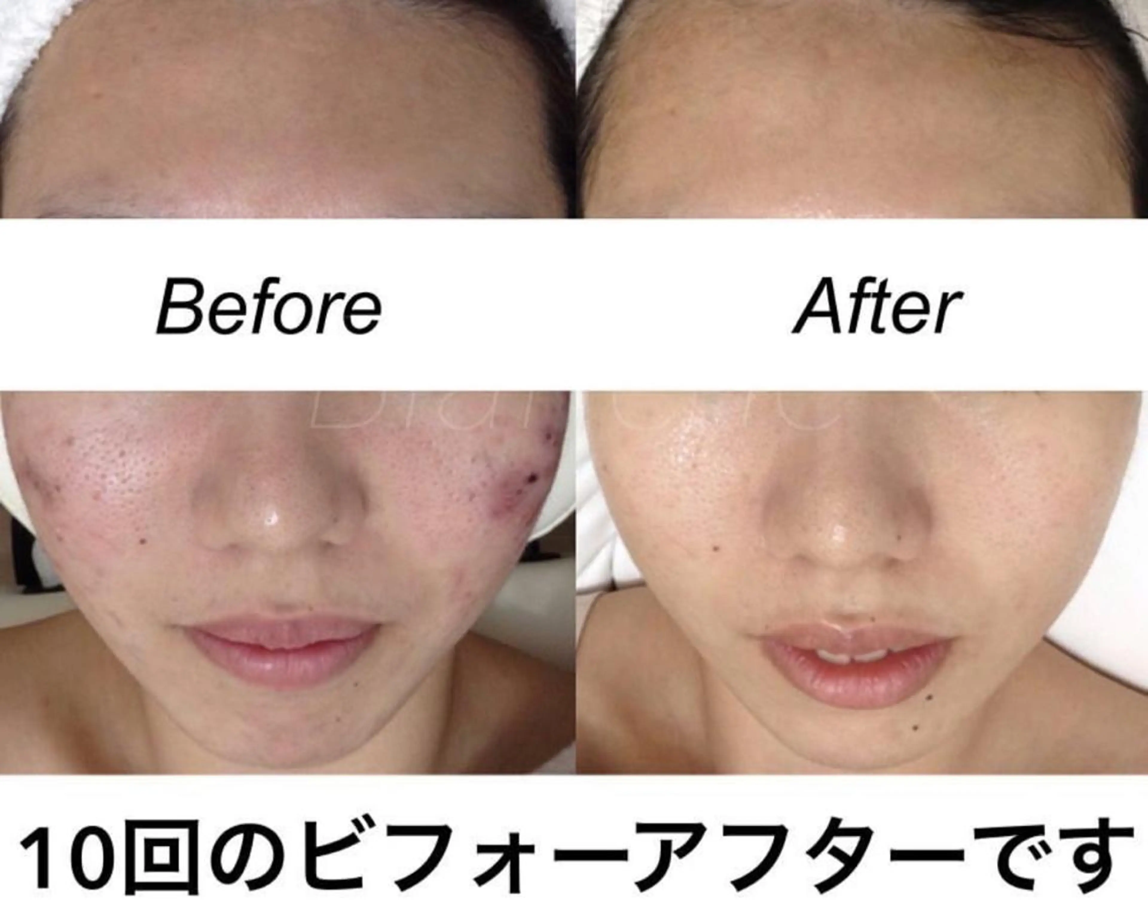 ショート カラー パーマ ヘアアレンジ キッズ ネイル マツエク・マツパ エステ リラク 都度払い肌質改善 &脱毛Blancheのエステ・リラクイメージ