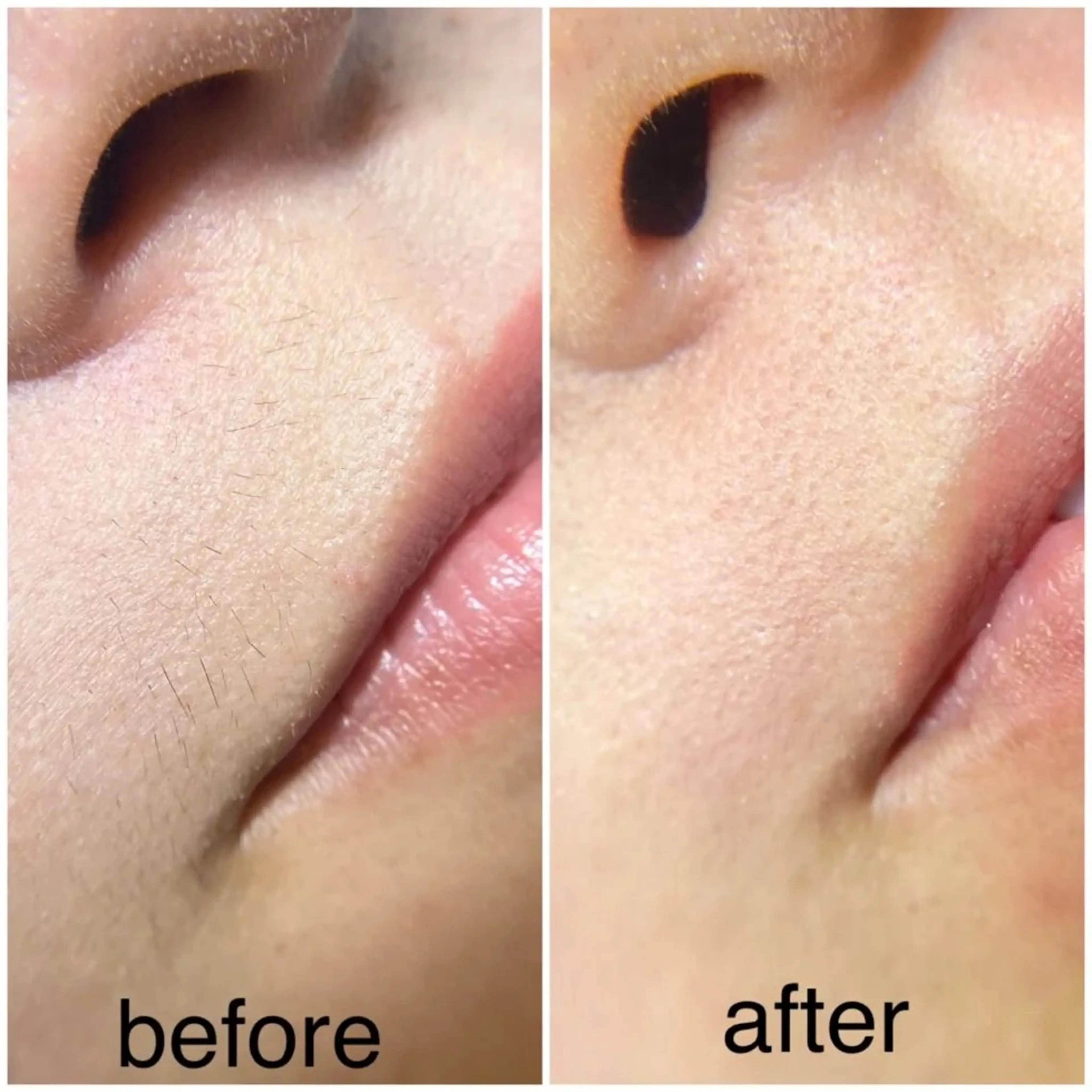 エステ ニキビケア&毛穴改善サロン GLOW所属・GLOW フェイシャルサロンのエステ・リラクイメージ