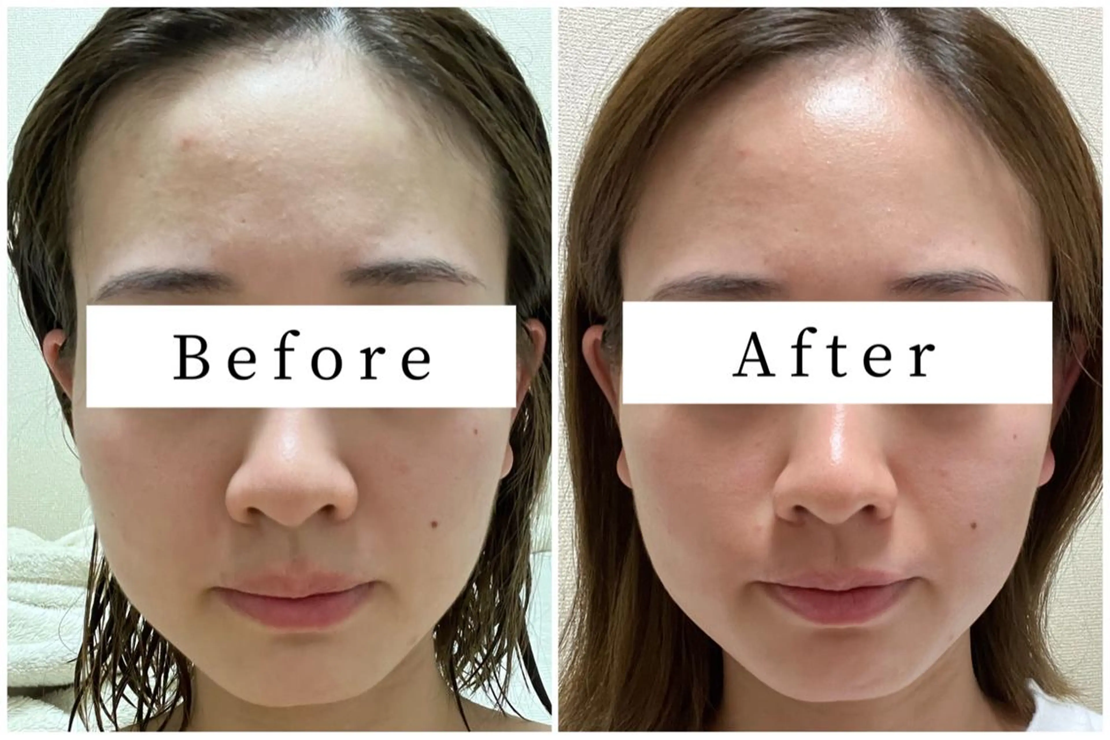 ハーブピーリング専門 muro.のエステ・リラクイメージ