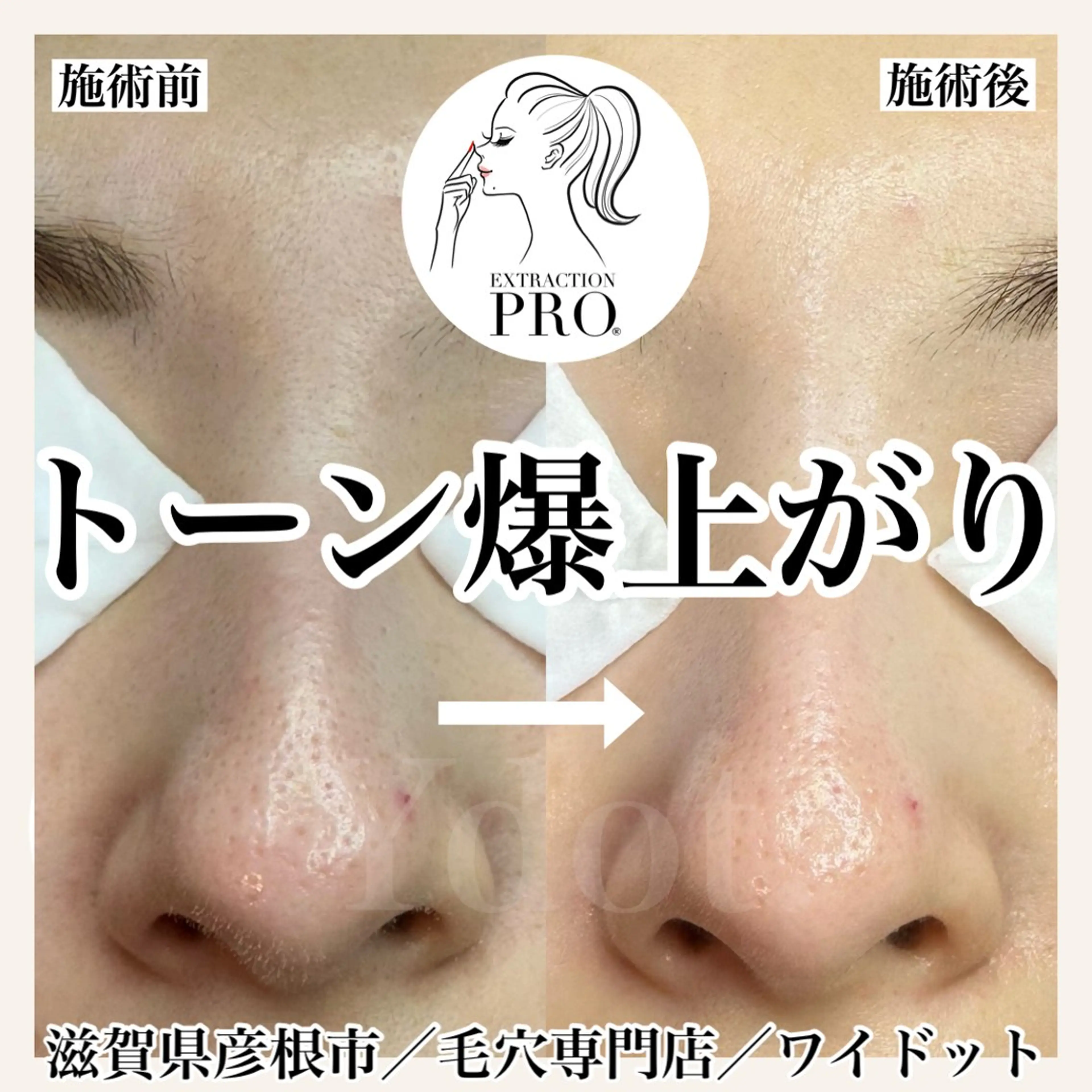 エステ Ydot. 池内 友架のエステ・リラクイメージ