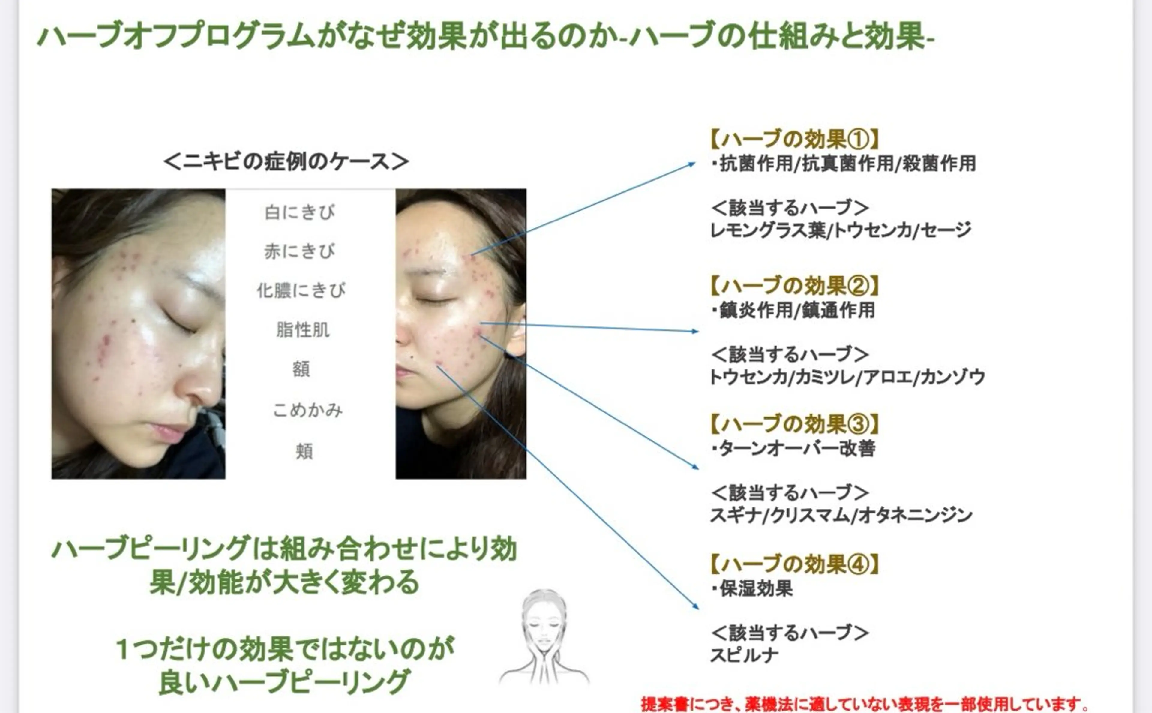 脱毛エステサロン PEAKのエステ・リラクイメージ