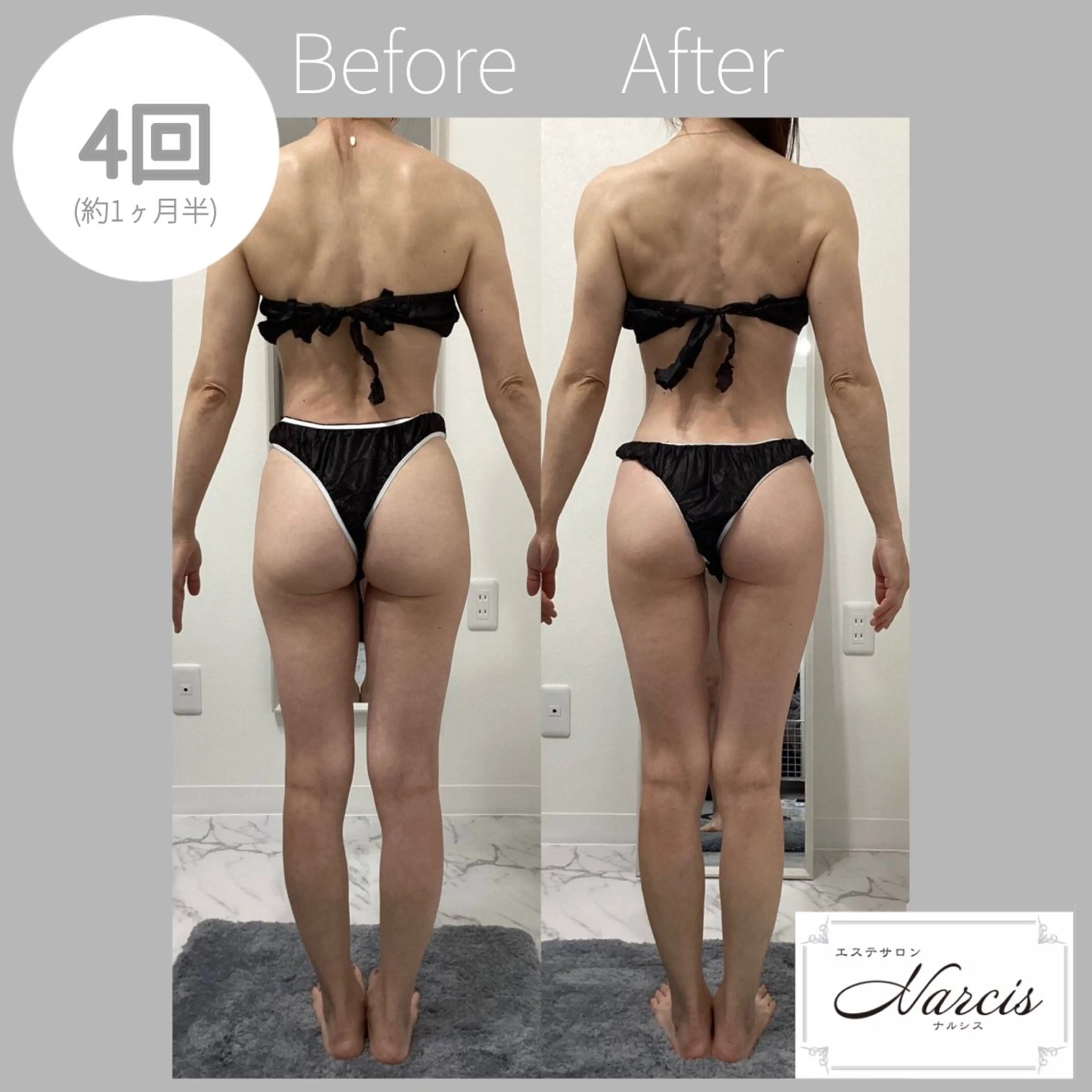 エステ エステサロンNarcis〜ナルシス〜所属・脱毛＆痩身エステ Narcisのエステ・リラクイメージ