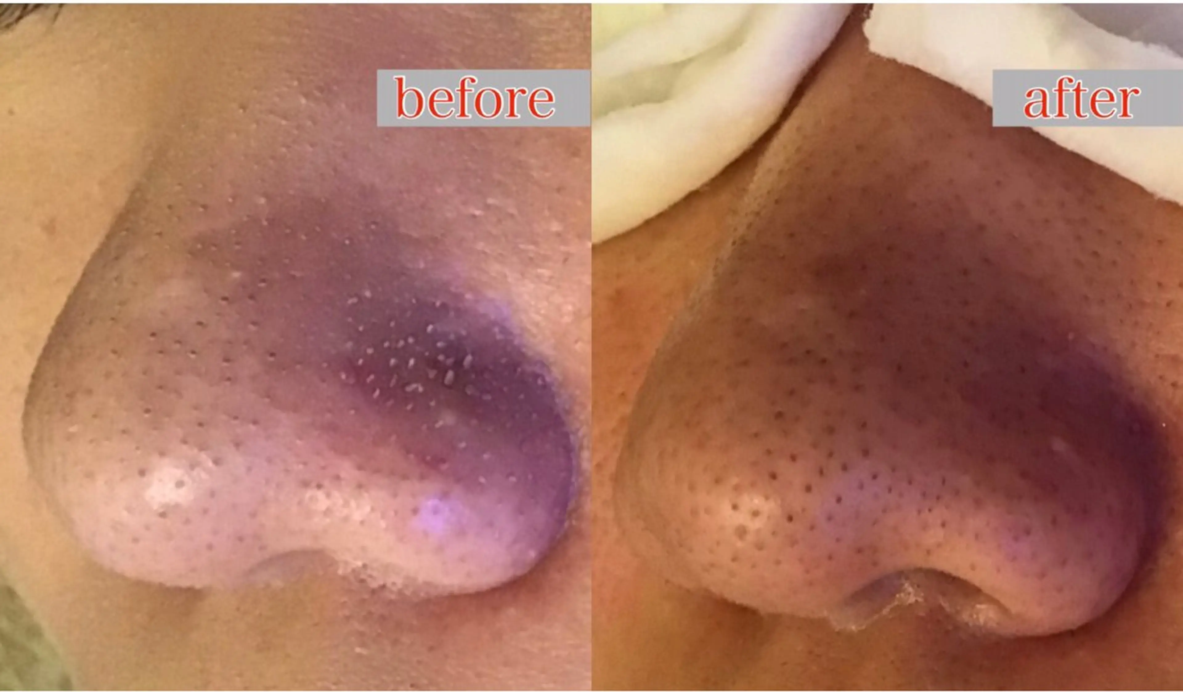 エステ BeautySalon　heart所属・Beauty Salonheartのエステ・リラクイメージ