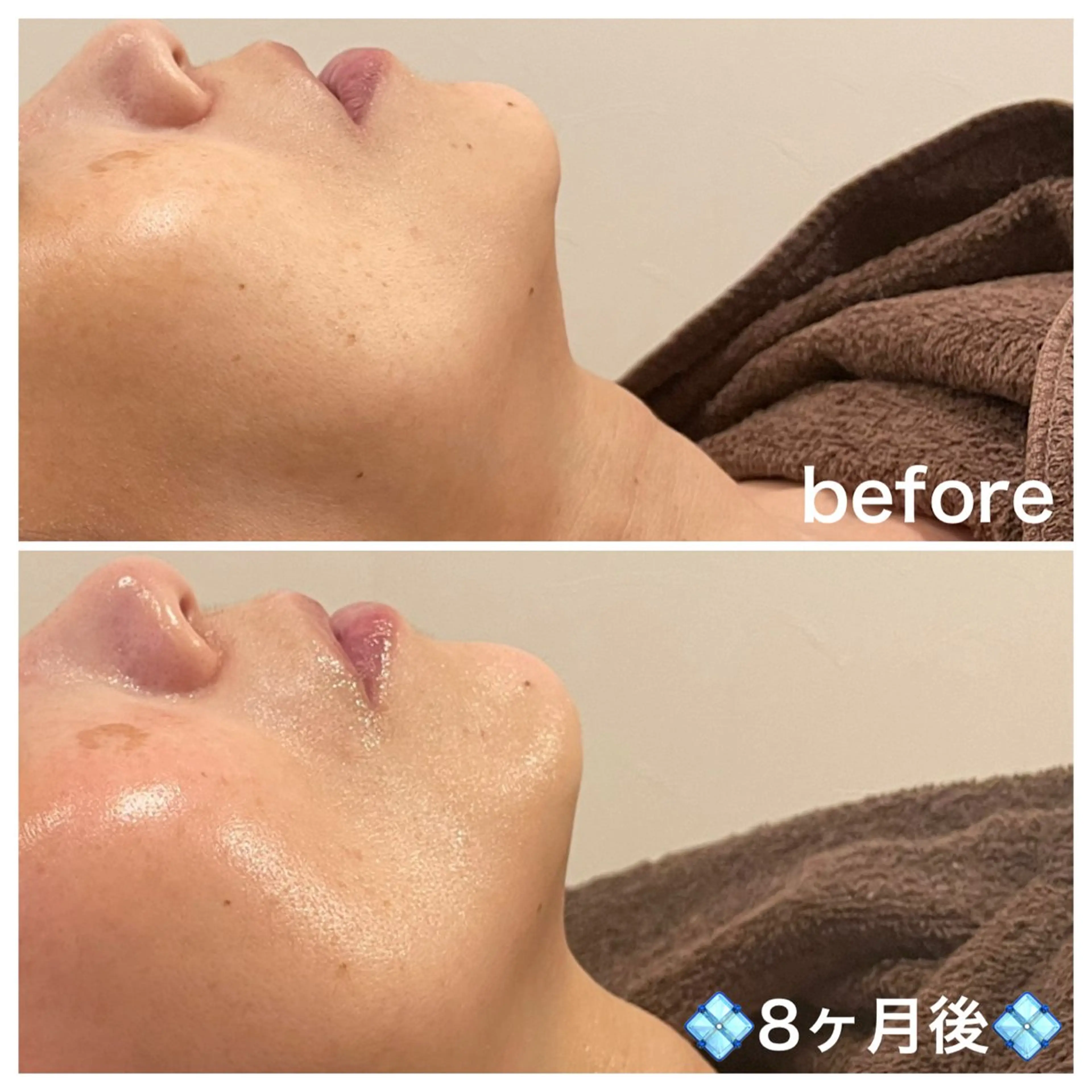 エステ 浜野 恵美のエステ・リラクイメージ