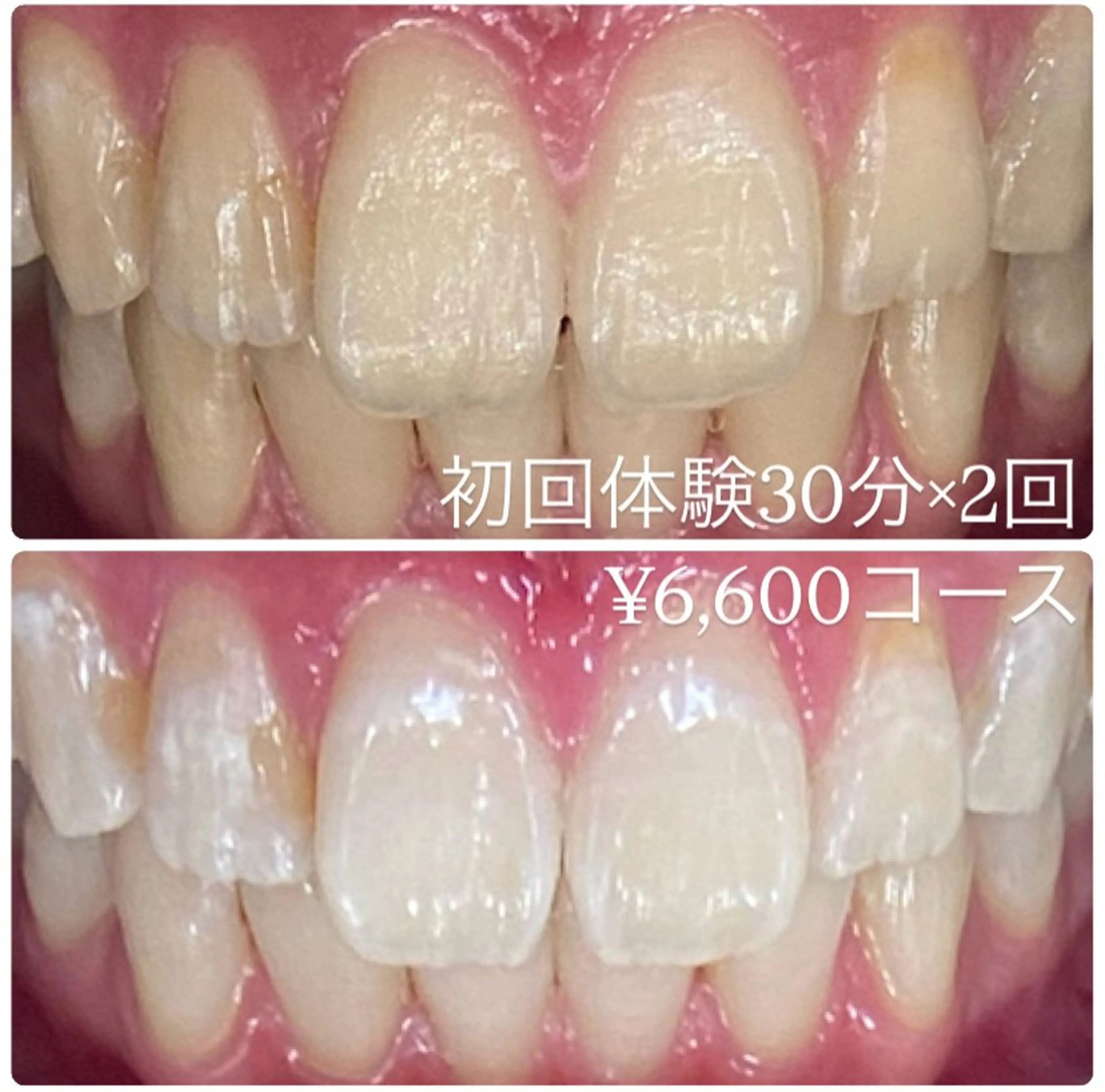 PLATINUM Beauty 横浜店所属・ホワイトニングルーム 横浜店のその他イメージ