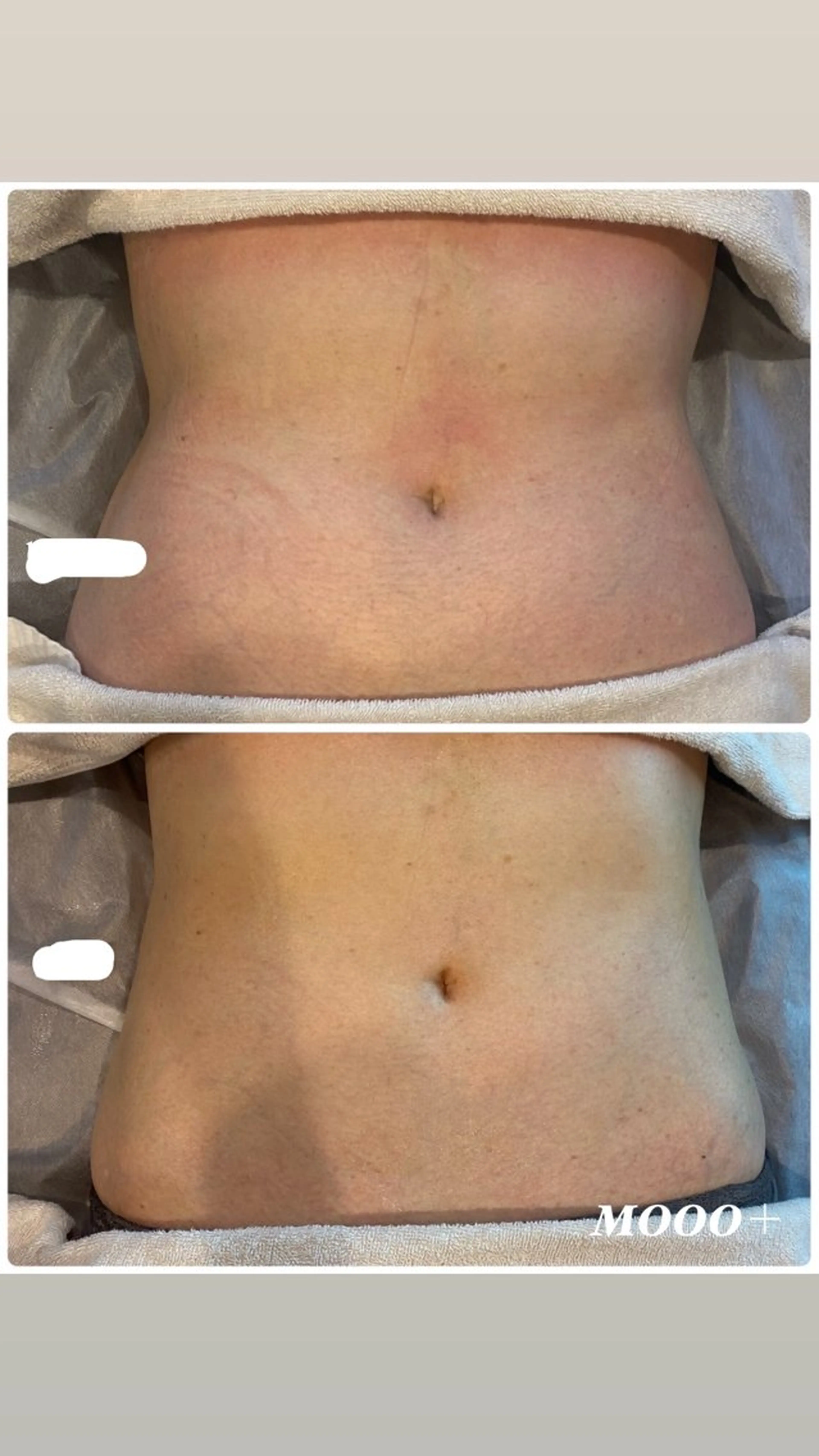 MOOO+所属・ダイエット痩身エステ ★MOOO＋のエステ・リラクイメージ