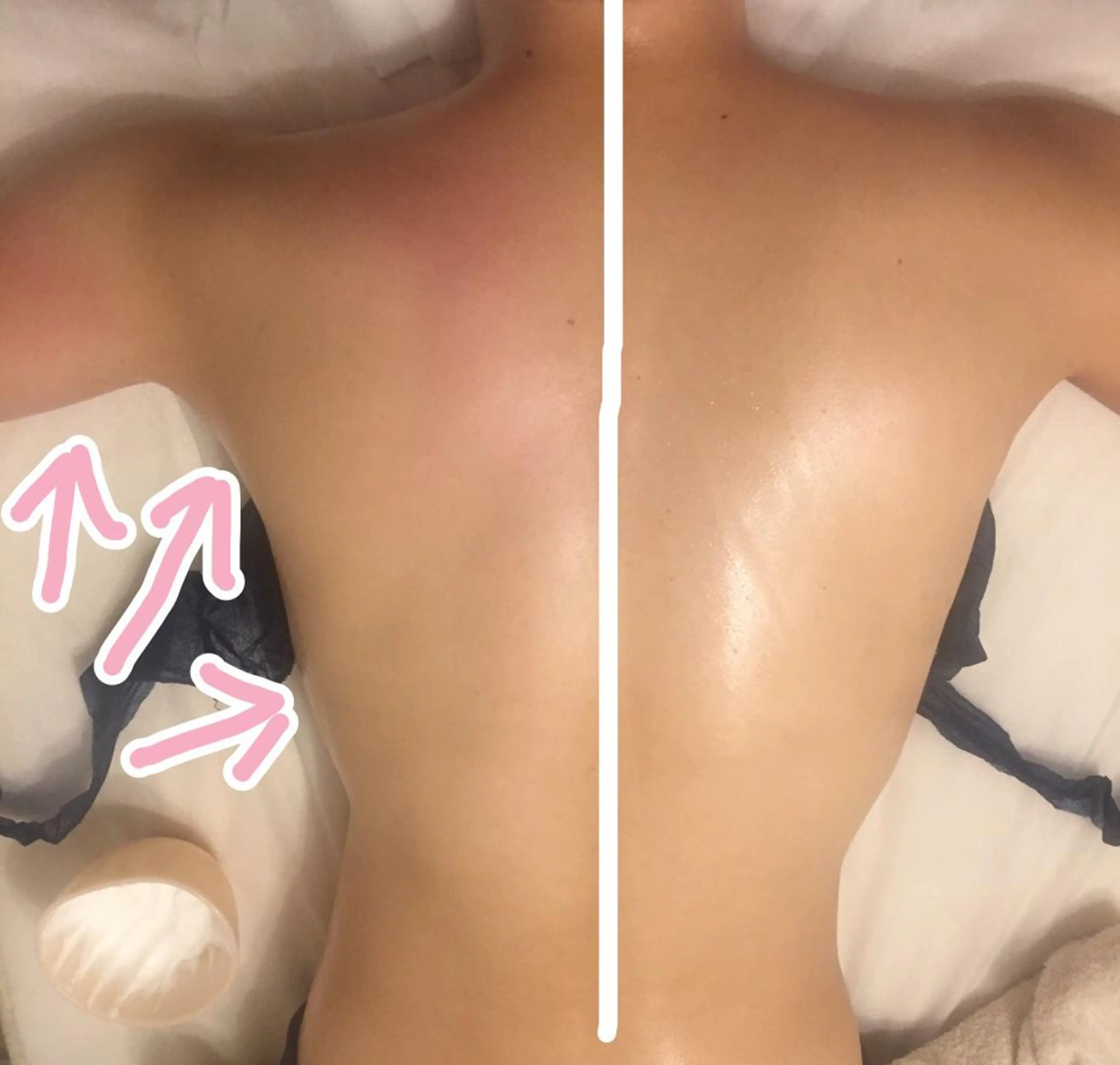 【ニキビ/肌管理】 salon varyのエステ・リラクイメージ