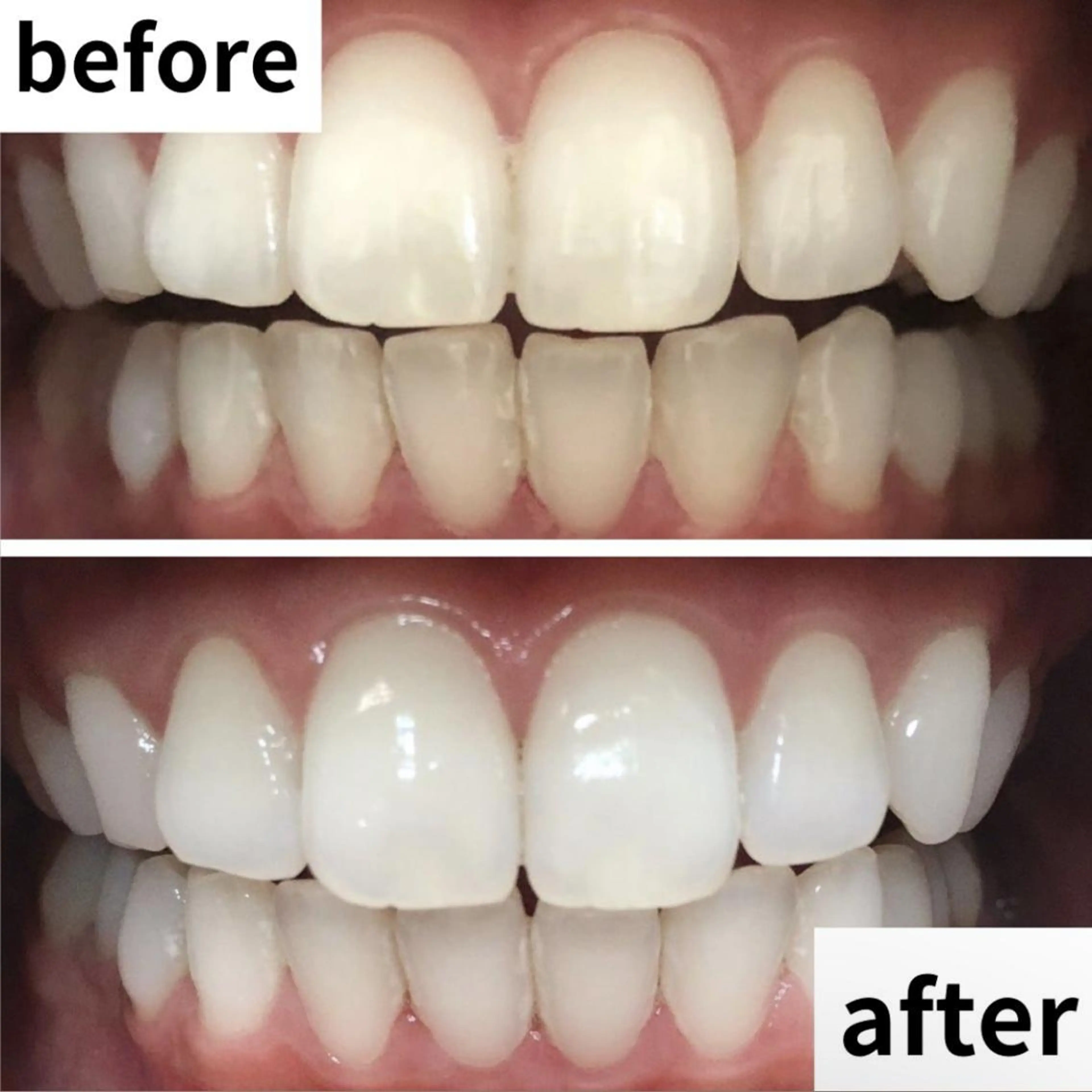 LBSホワイトニング 🌐渋谷店 小河原のエステ・リラクイメージ