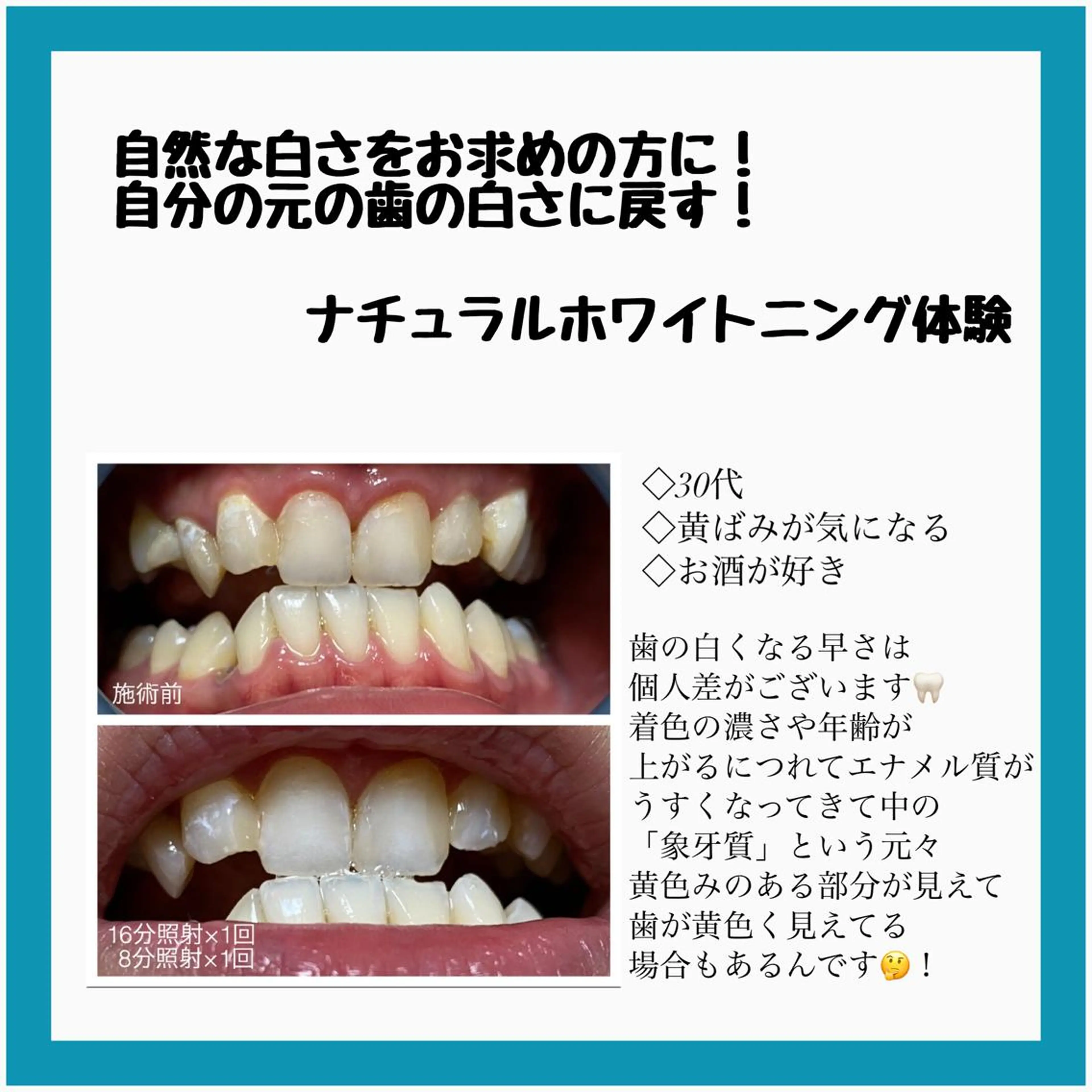 ネイル/耳つぼ /新ホワイトニングのネイルデザイン