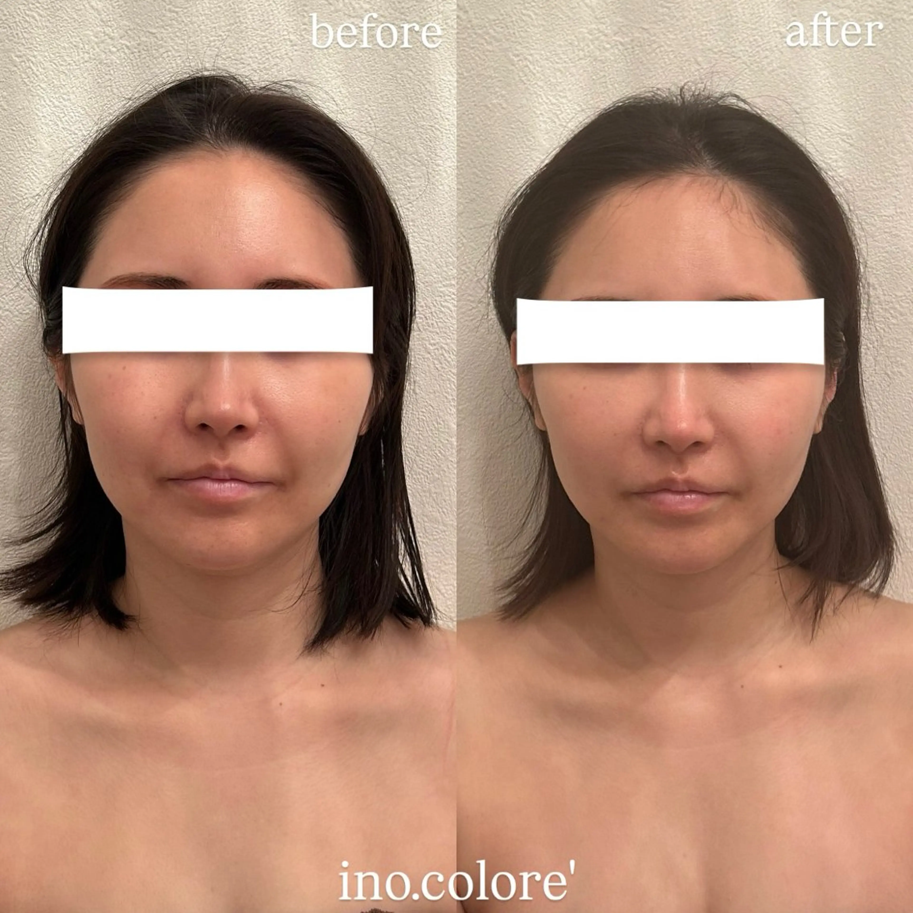 エステサロンino.colore'所属・小顔サロン ino.coloreのエステ・リラクイメージ