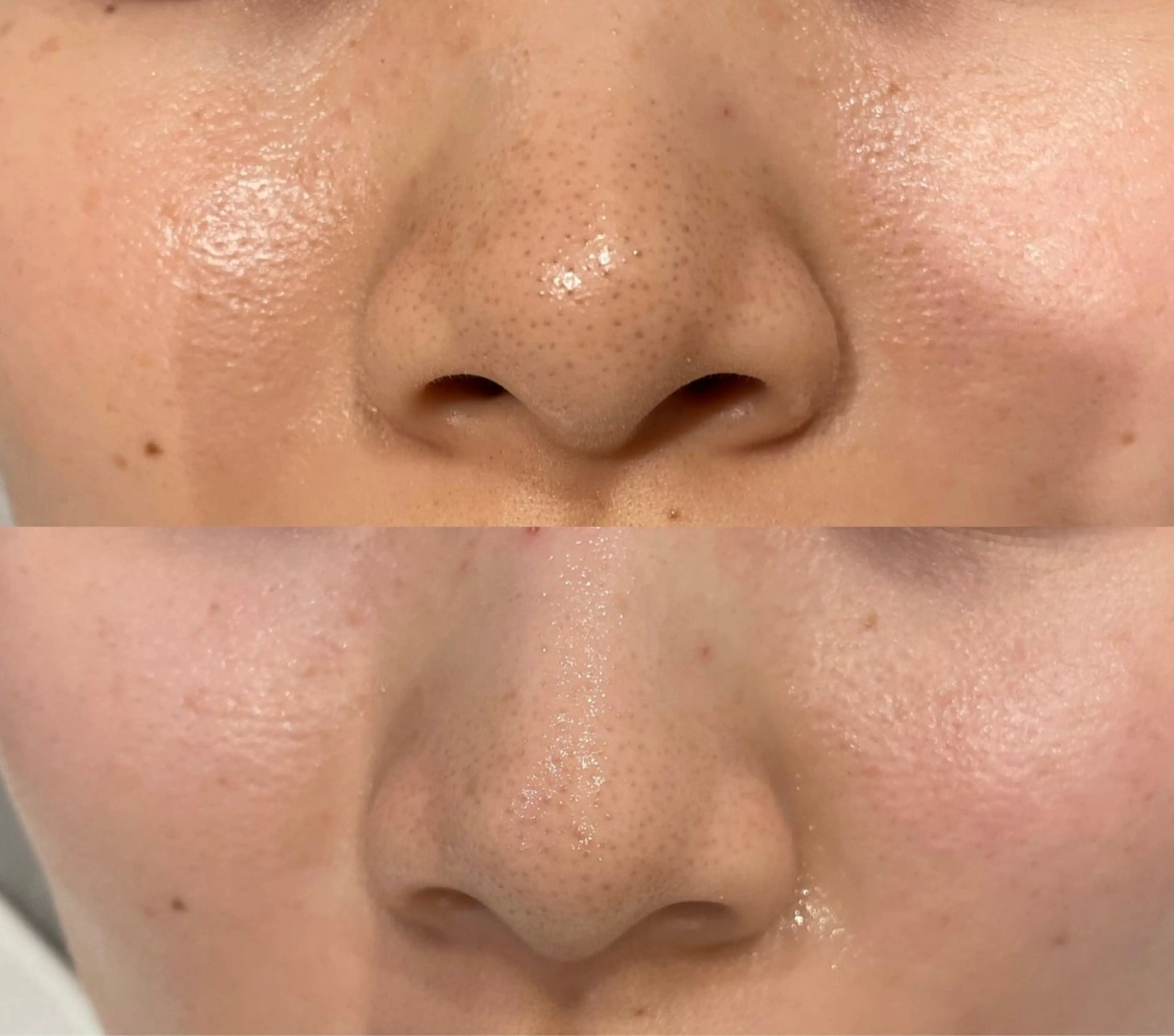 DeI'm   名古屋栄所属・小林 玲菜のエステ・リラクイメージ