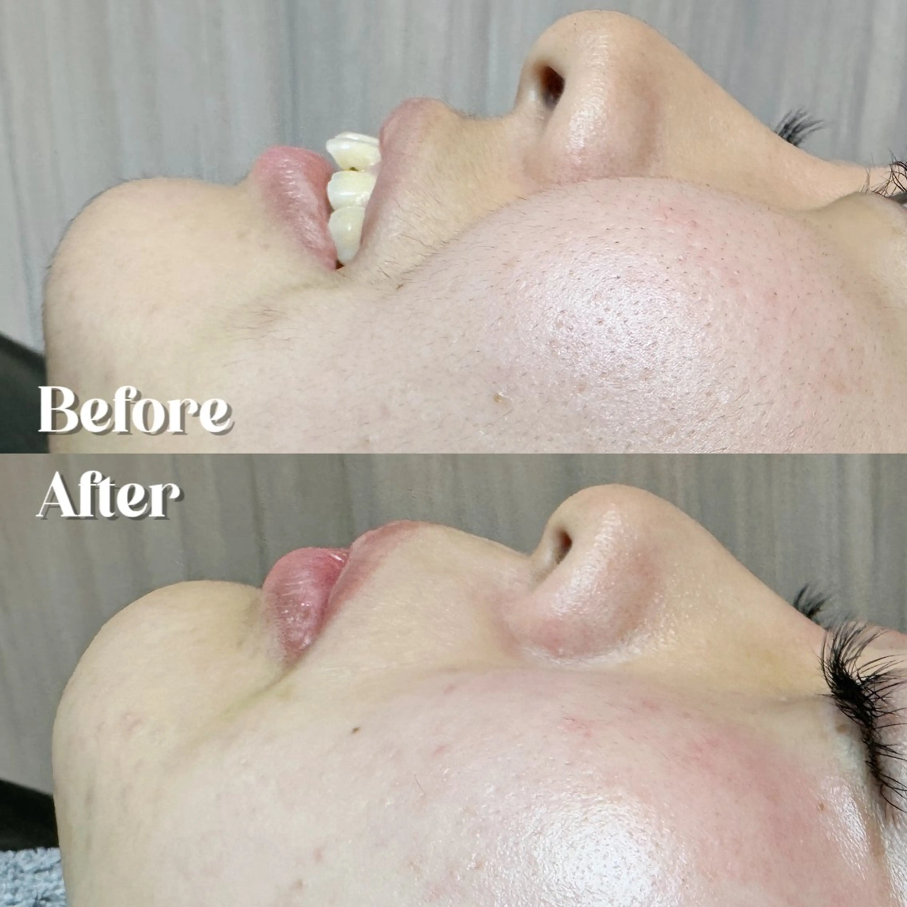 Hit. シュガーリング豊橋のエステ・リラクイメージ