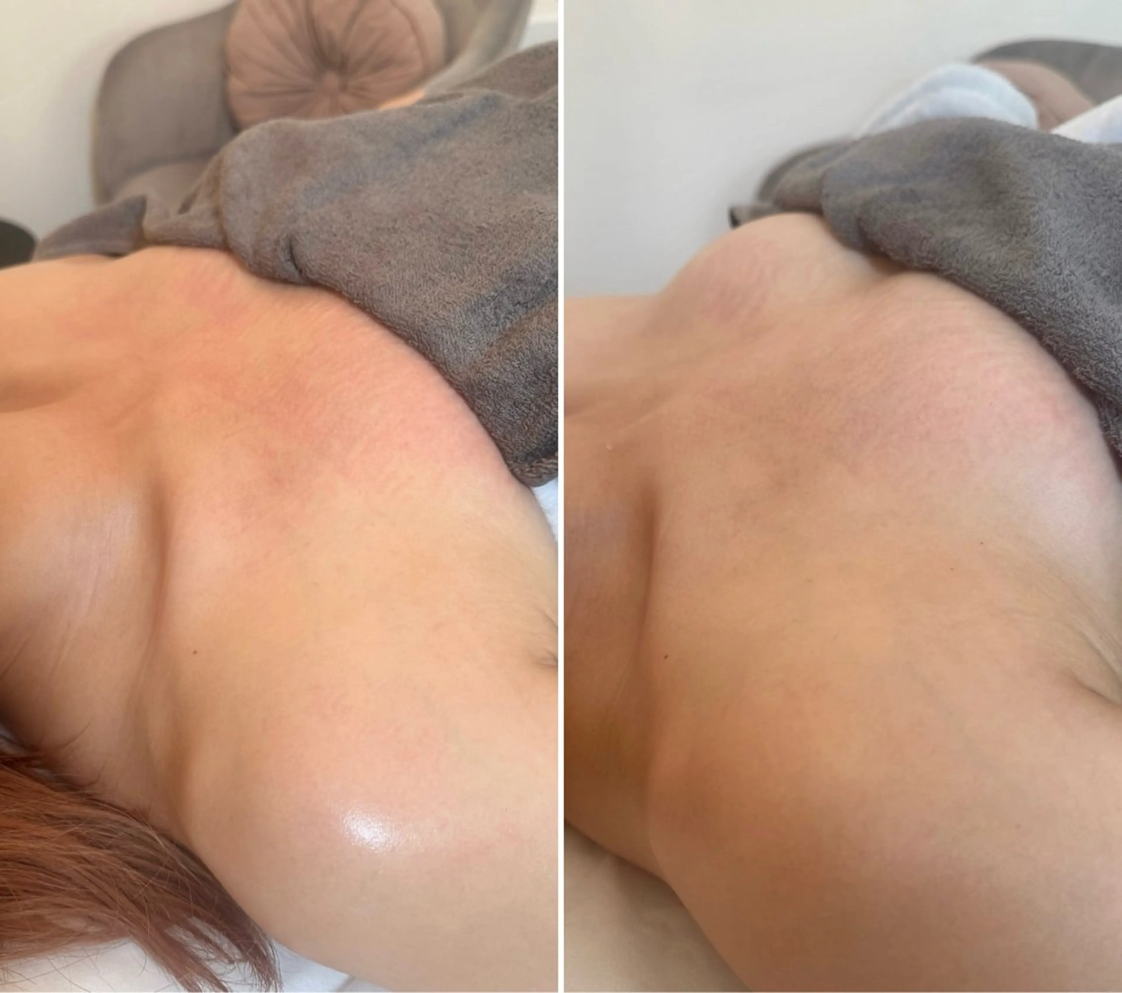 3名様限定モニター:ふんわり弾む美胸コース💖(全3回)の写真