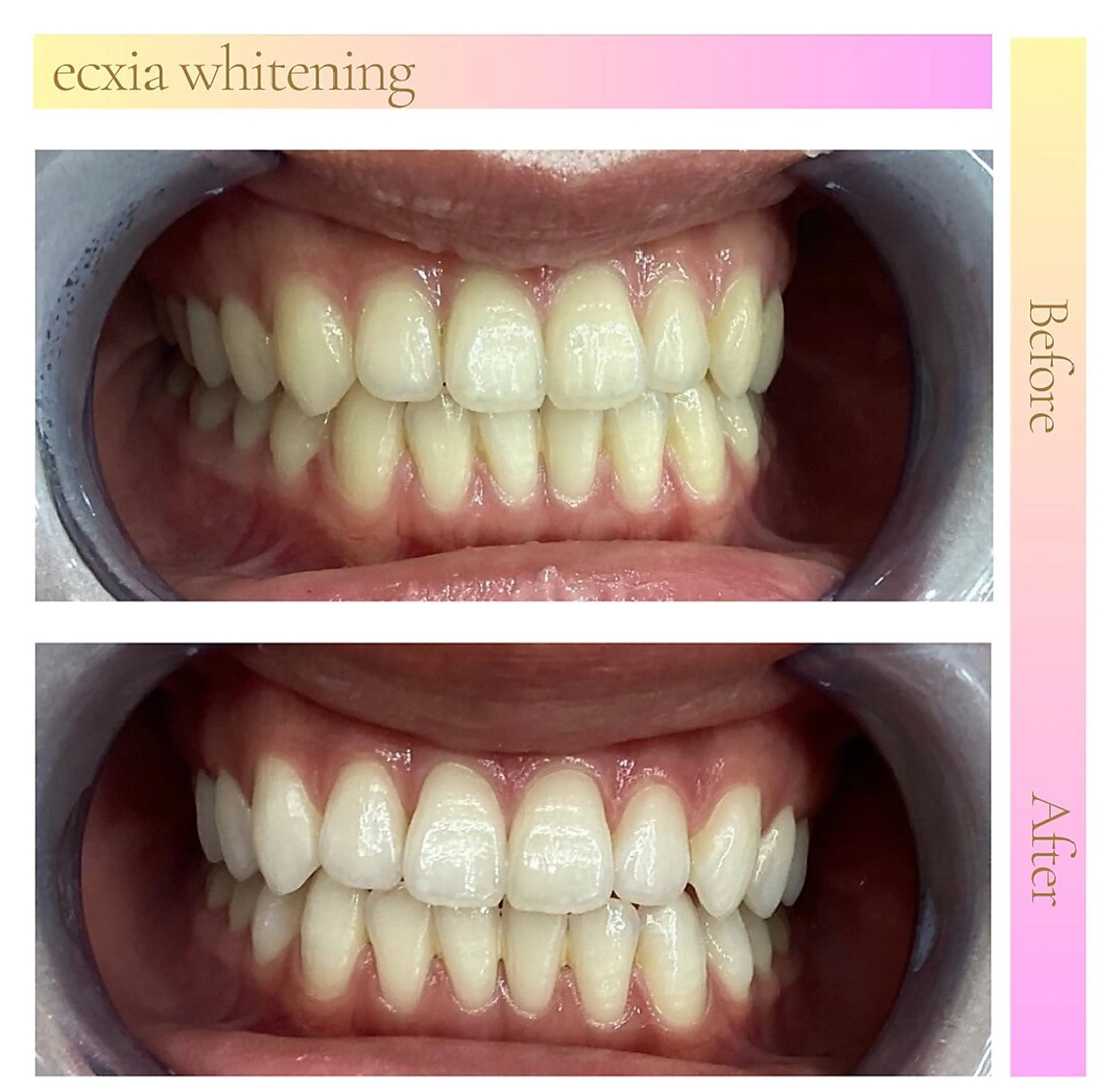 ecxia  white 　広島袋町店所属・セルフホワイトニング エクシア広島袋町店のその他イメージ