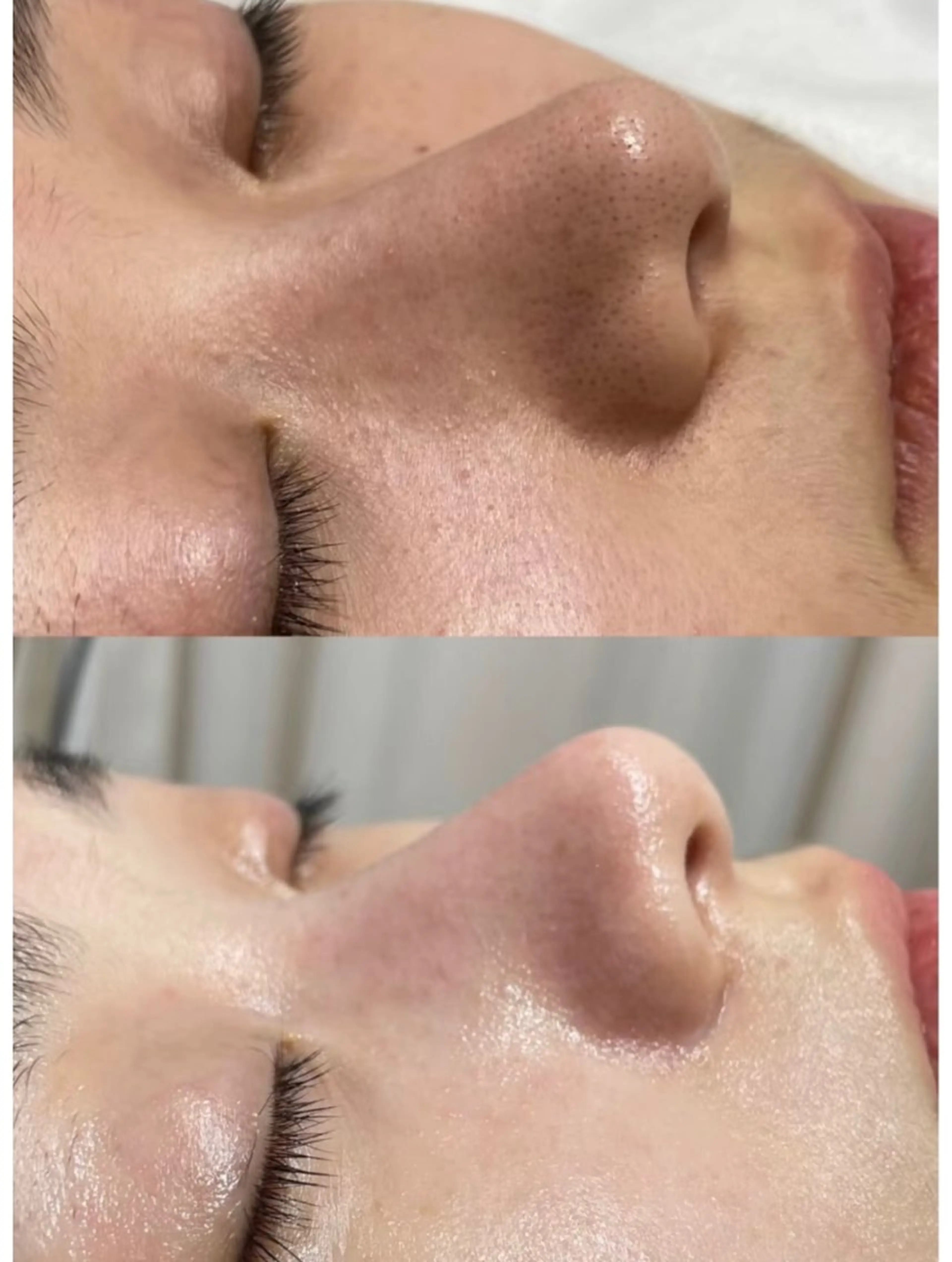 エステ 韓国式肌管理＆毛穴洗浄　THE ONE栄店所属・Theone 福本のエステ・リラクイメージ