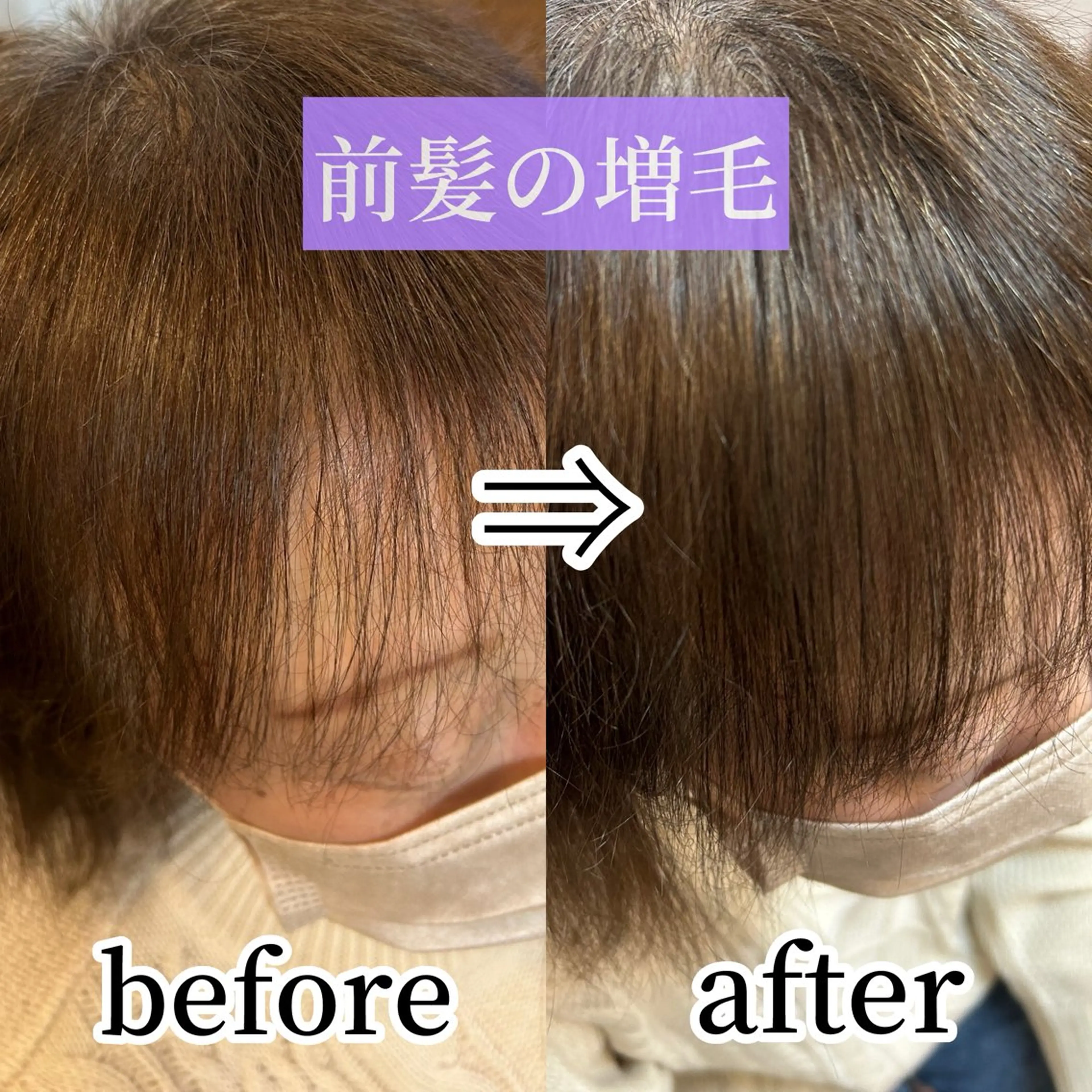 Lily所属・大野 友梨のヘアスタイル