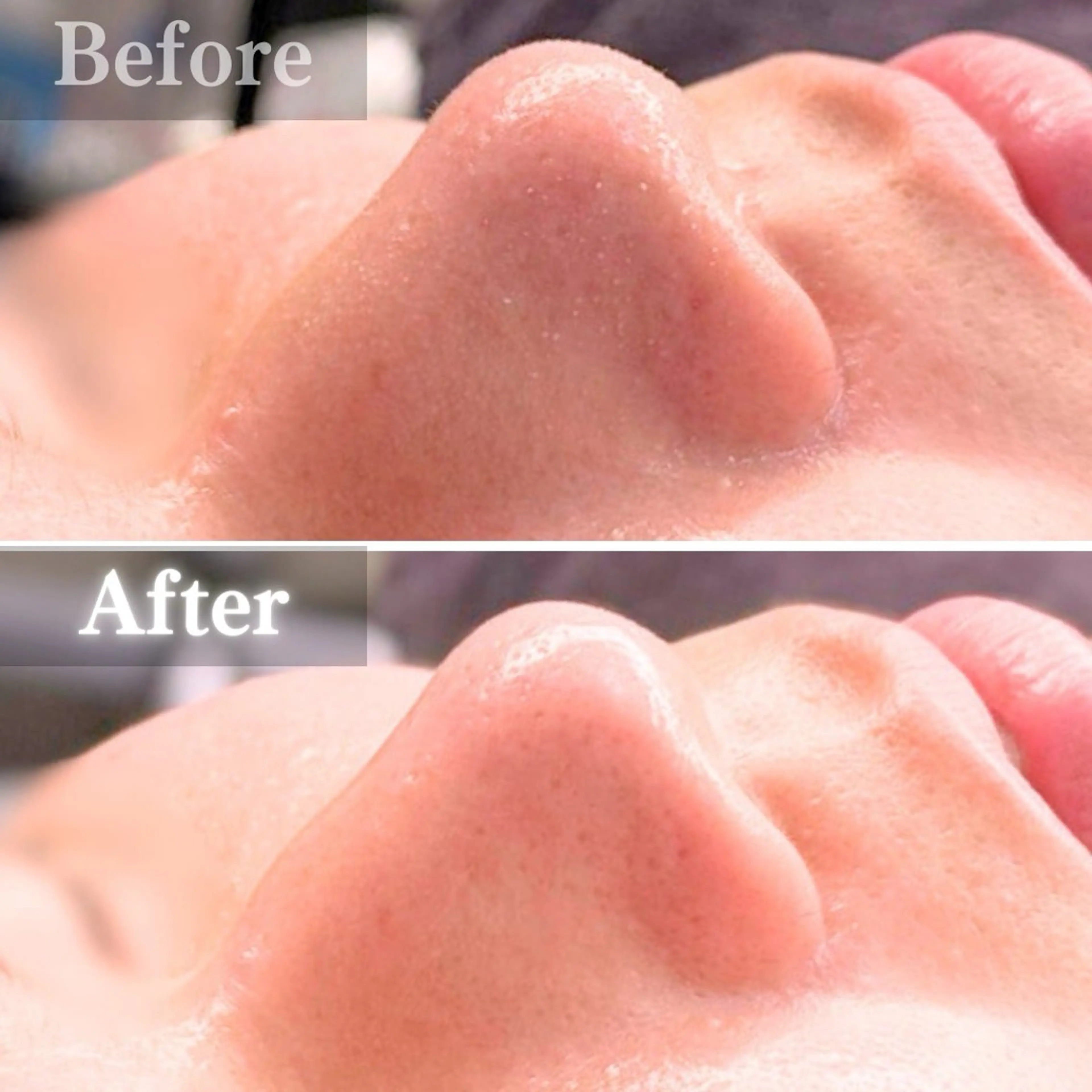 エステ 毛穴洗浄特化🫧 オオツカのエステ・リラクイメージ