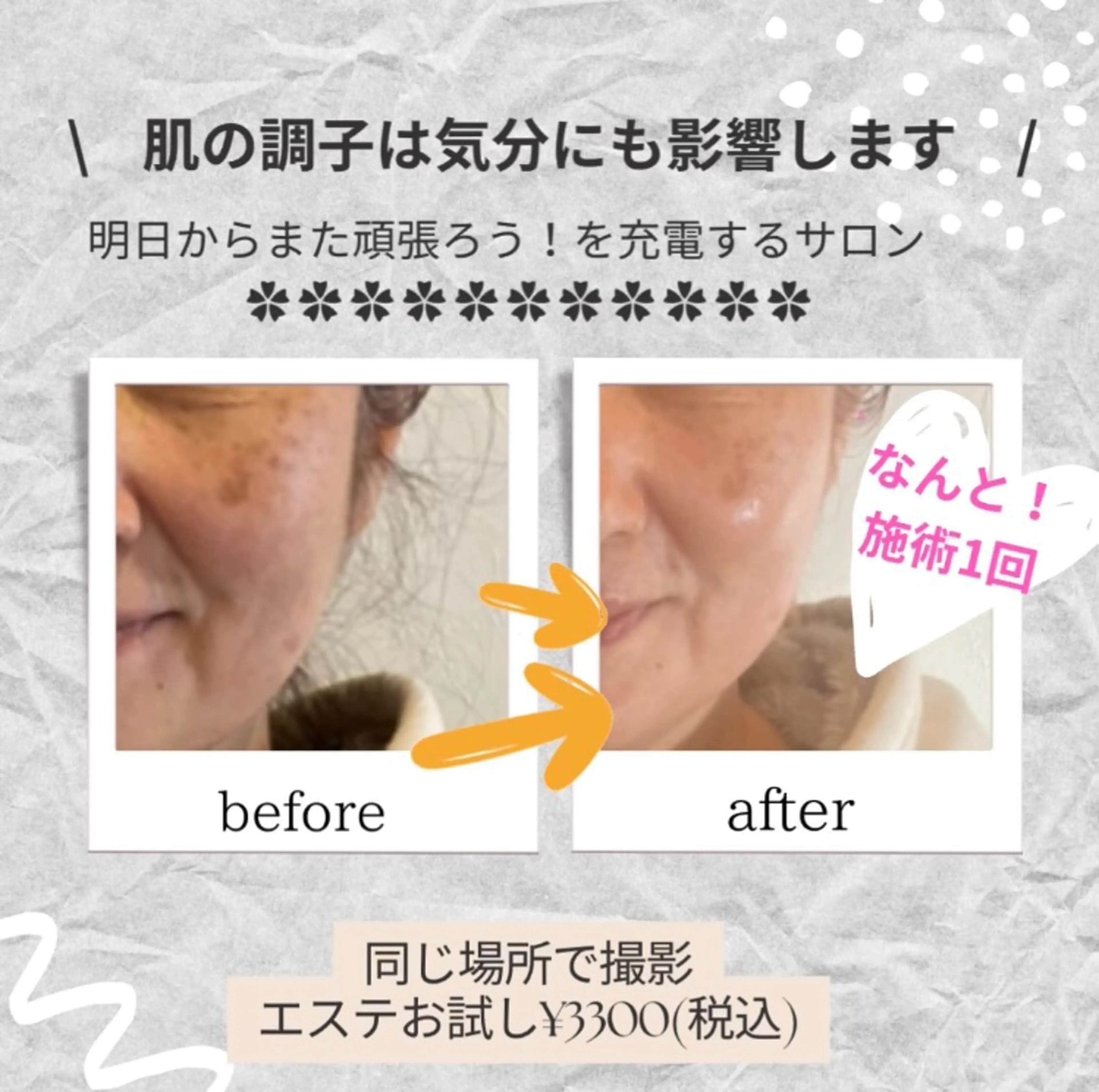 フェイシャルサロン ビアンカガーデンのエステ・リラクイメージ