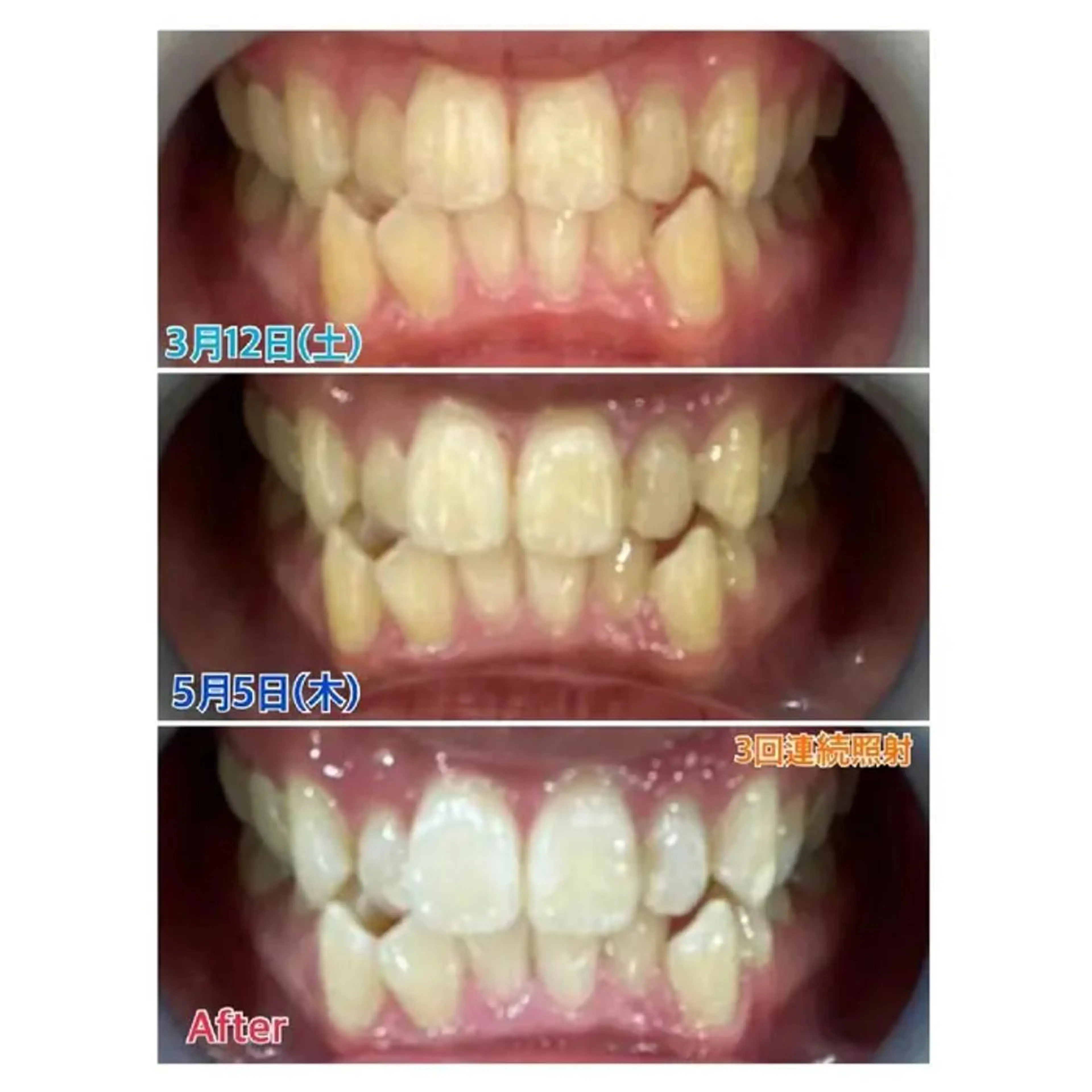 M渋谷店所属・Ｍ渋谷 ホワイトニングのその他イメージ