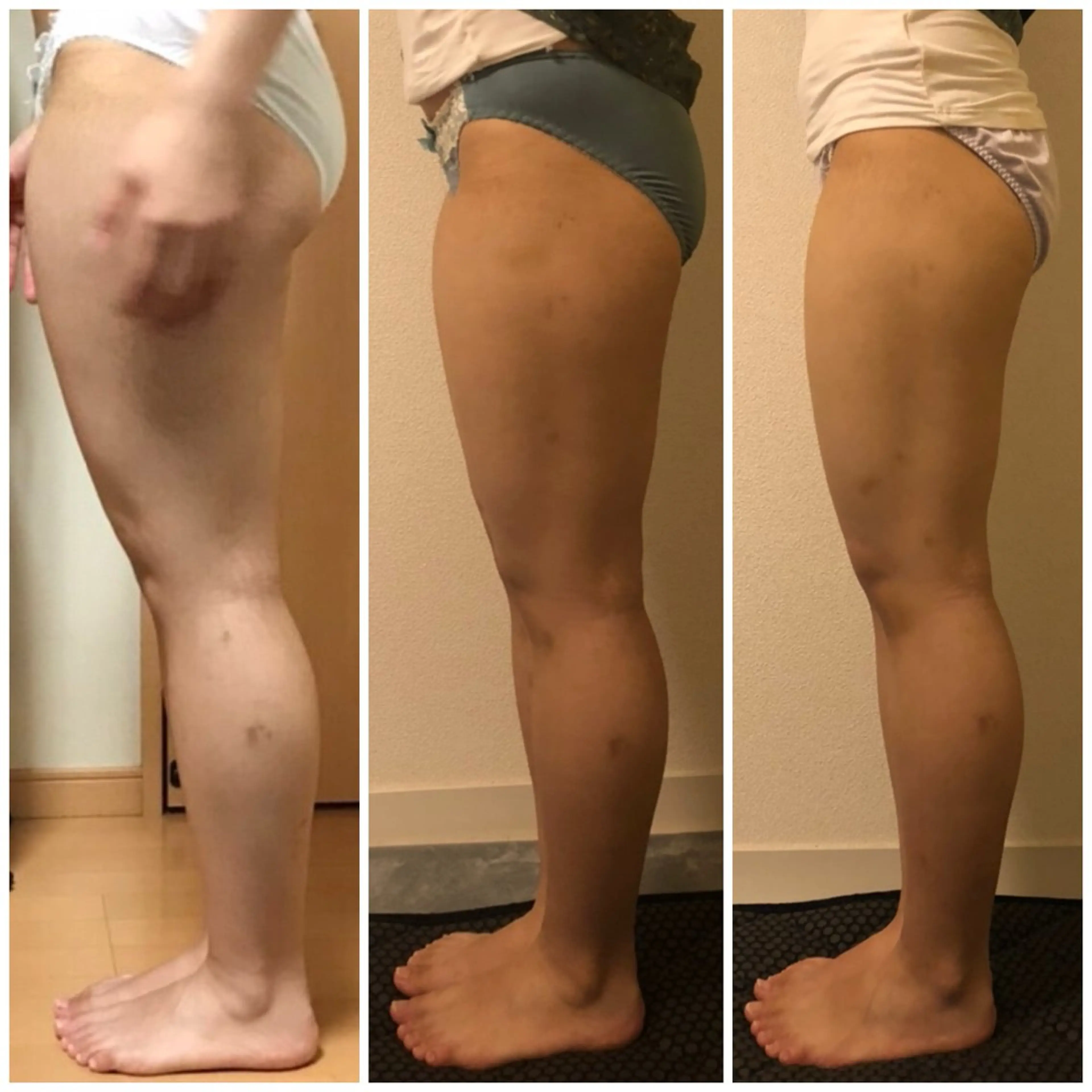 エステ リラク 痩せるハーブ蒸し／ 温活サロン imuaのエステ・リラクイメージ