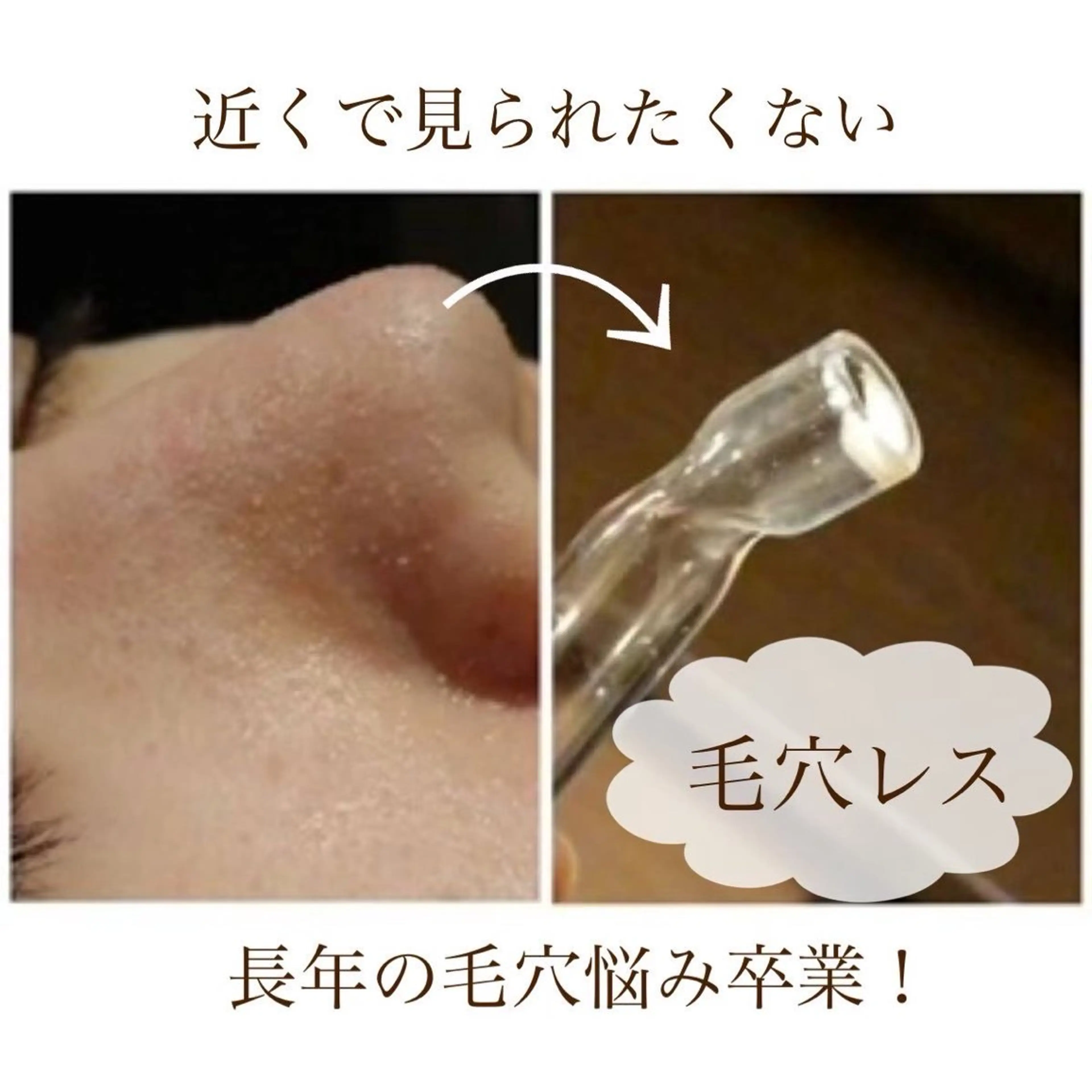 毛穴レスフェイシャルの写真