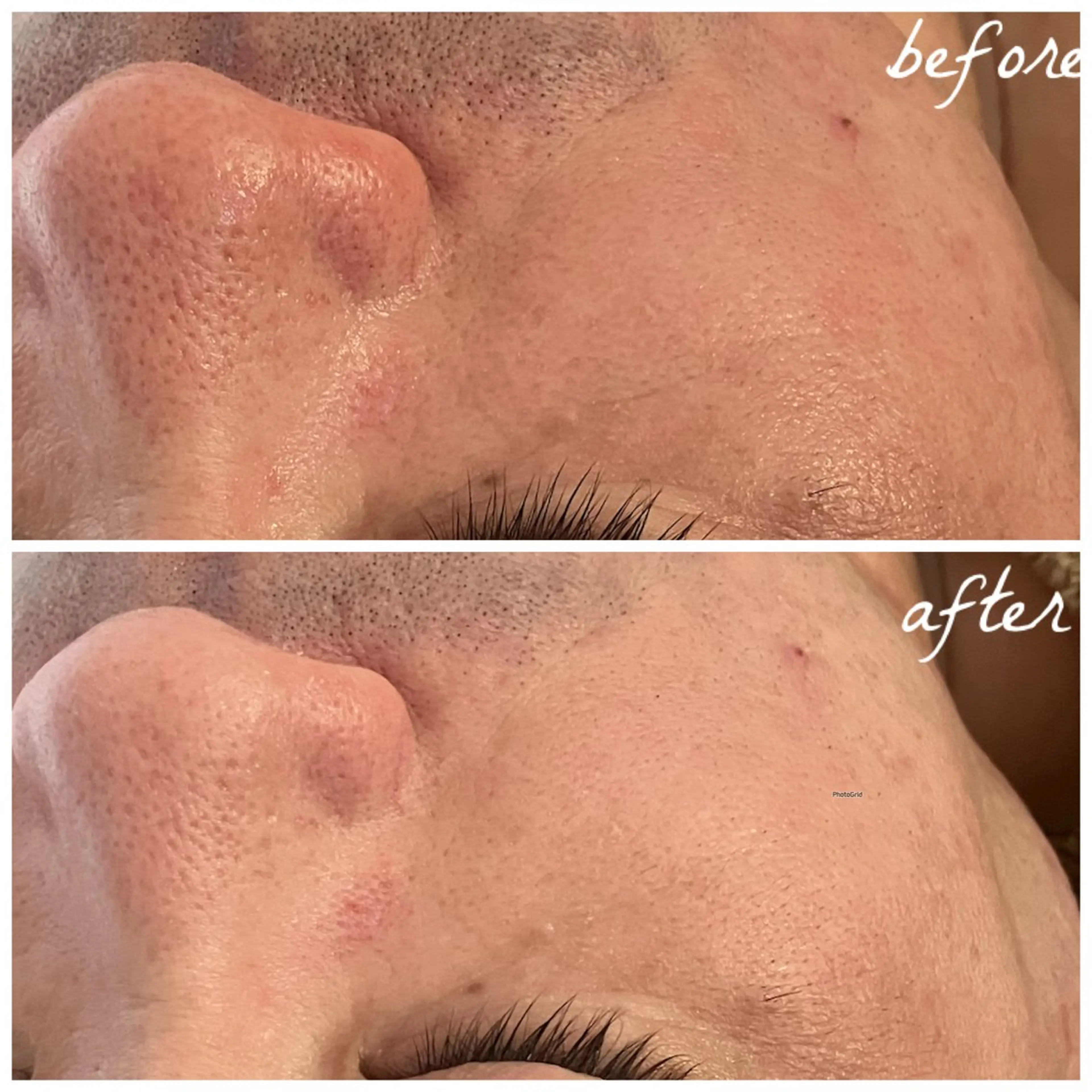 メンズ エステ メナード岐阜茜部 杉浦のエステ・リラクイメージ