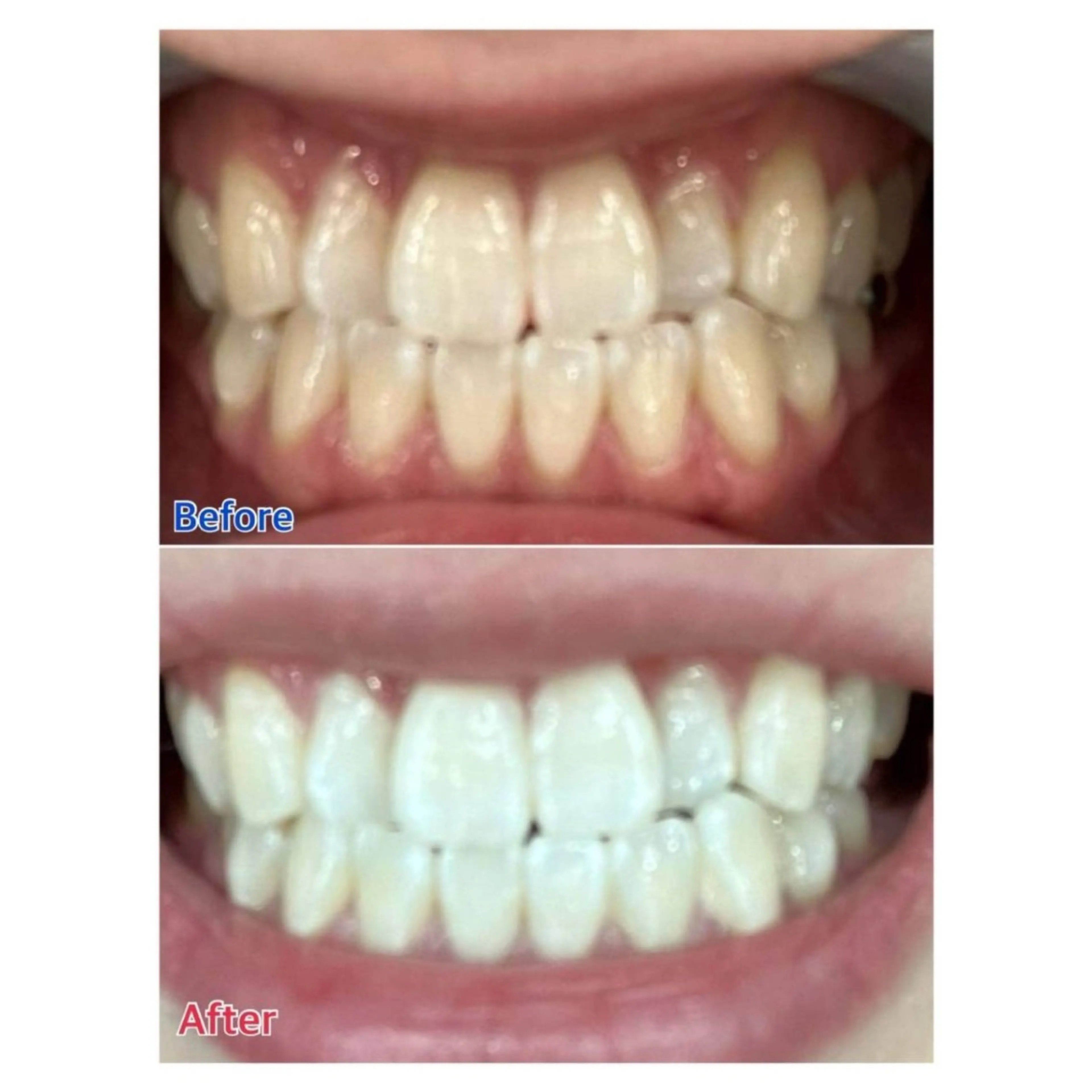 MBEAUTYSALON 千葉店・京成大久保所属・Melty 輝のその他イメージ