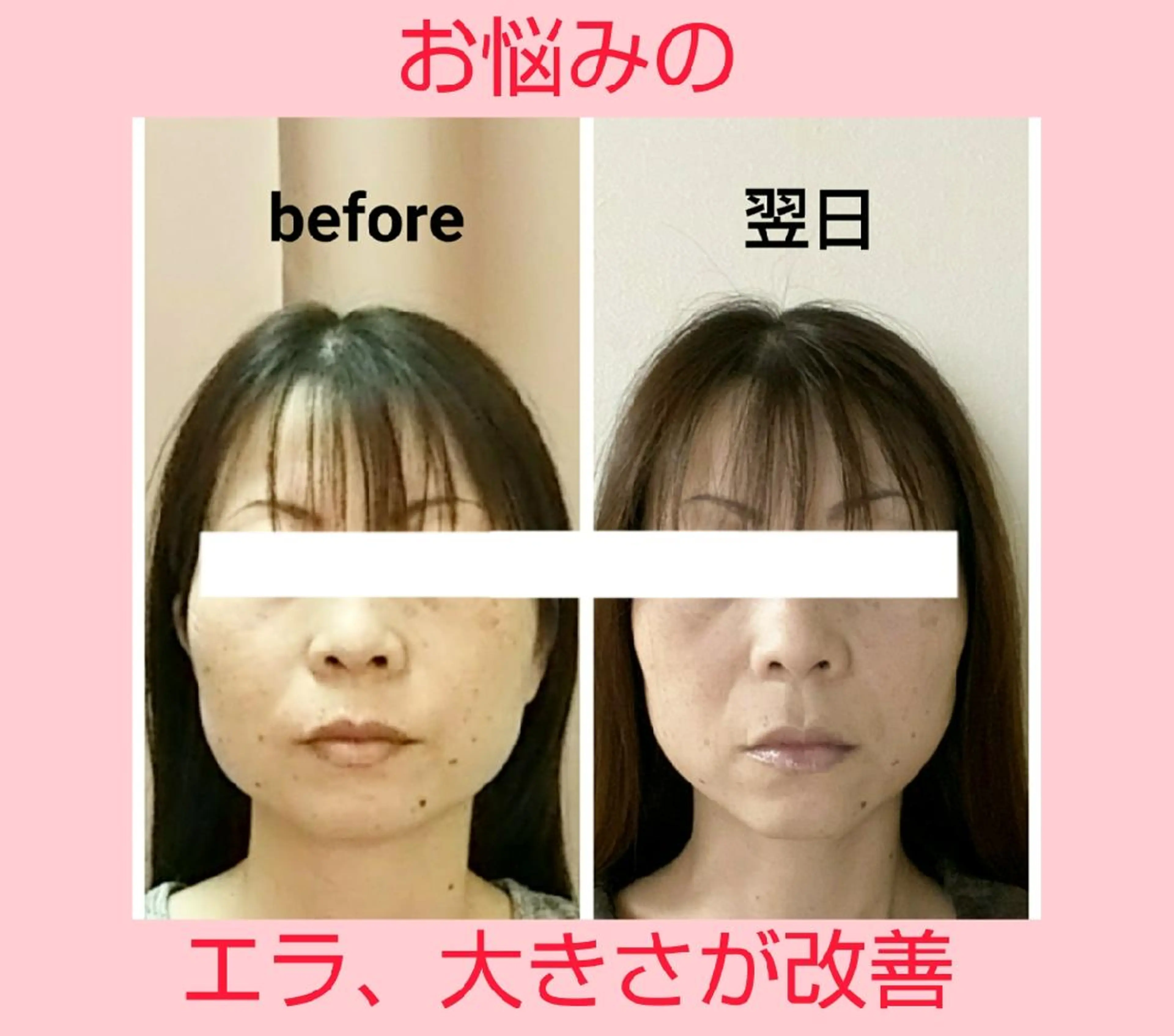 小顔と美肌 まごころエステMatoria所属・小顔 美肌専門 Matoriaのエステ・リラクイメージ