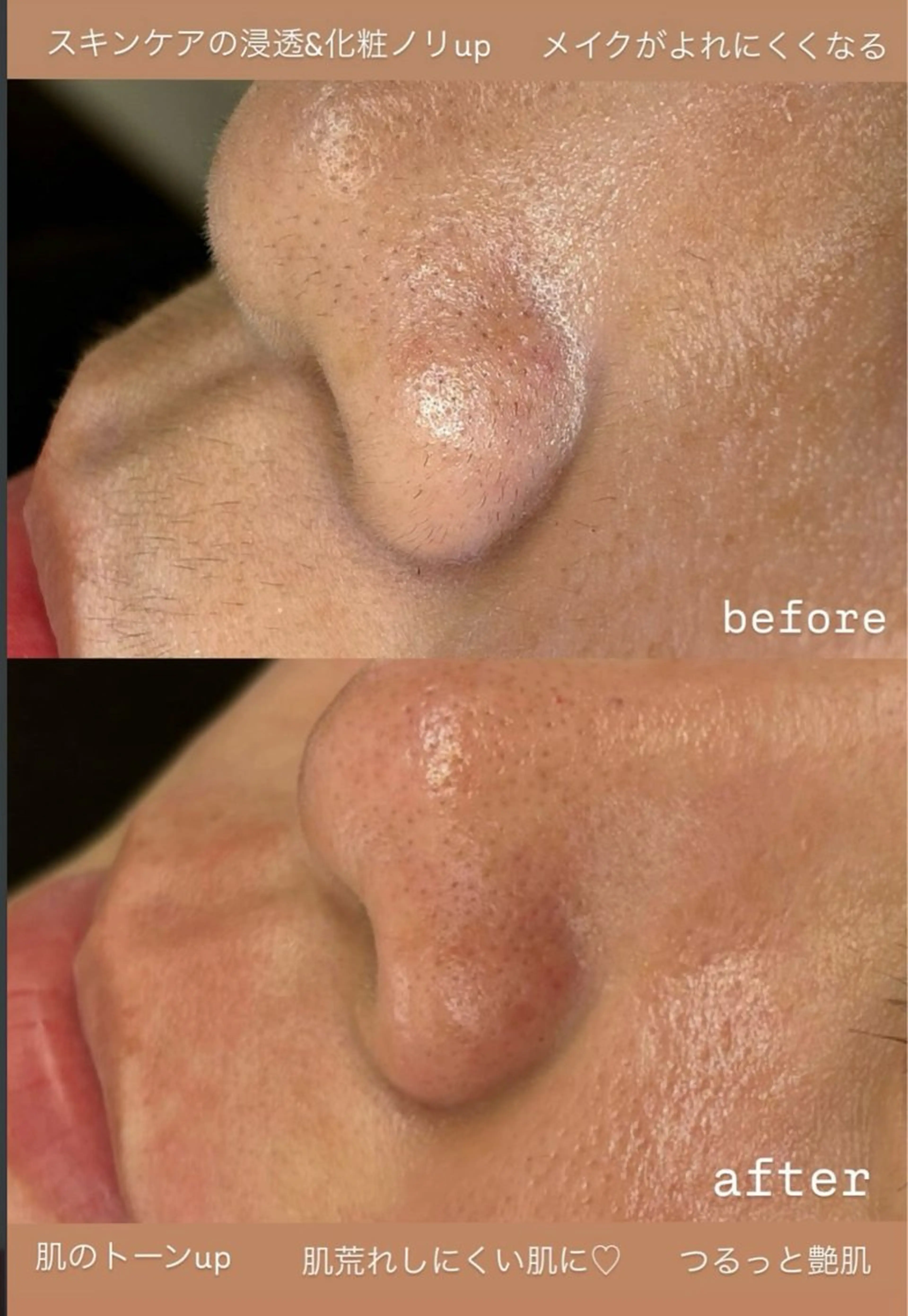 フェイスワックス (ビタミンCジェルパック付き✨)の写真