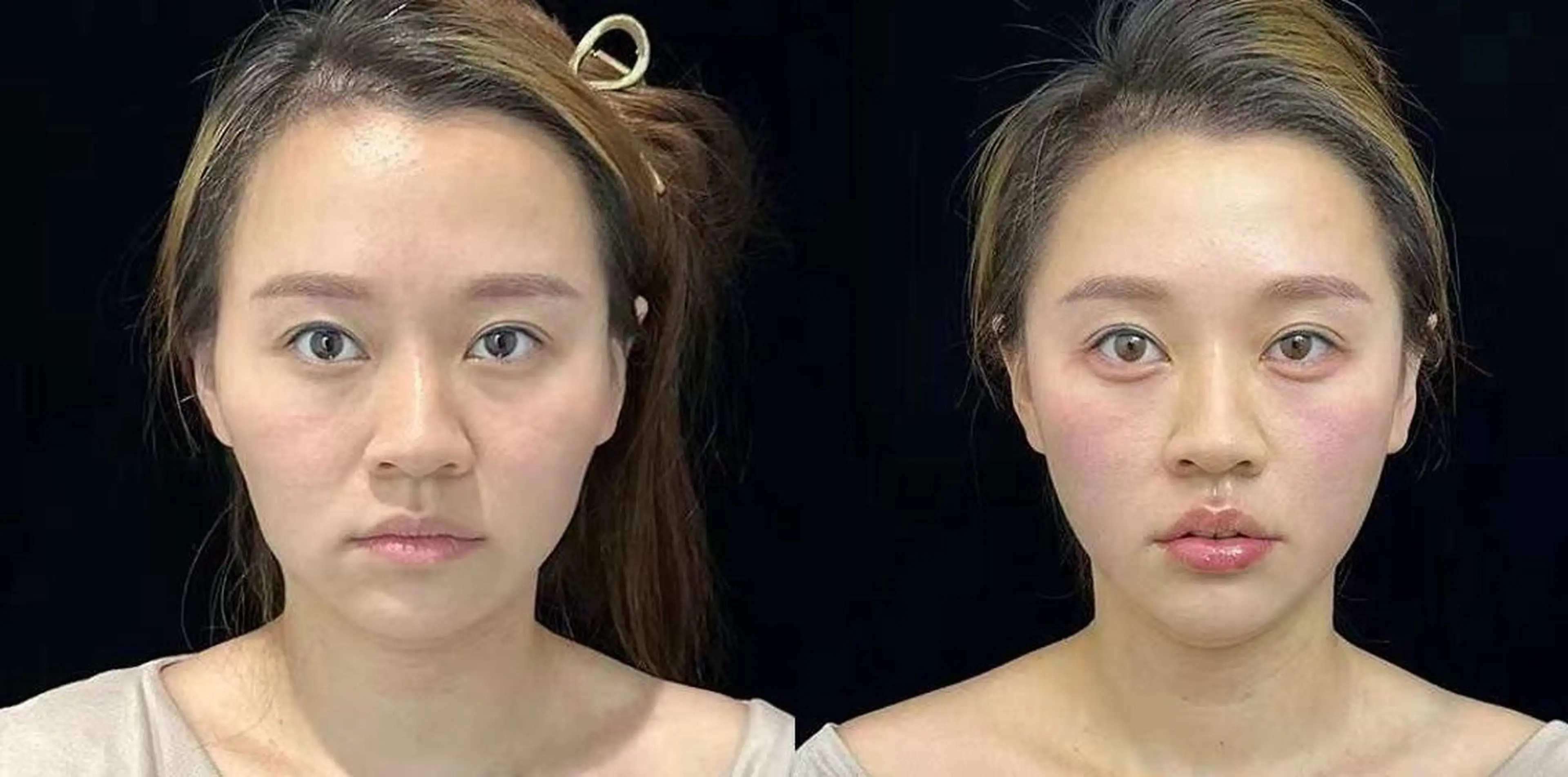 マツエク・マツパ エステ aliaハイフ&水光ジェットサロン所属・aliaハーブ水光店 エステティシャン募集のエステ・リラクイメージ