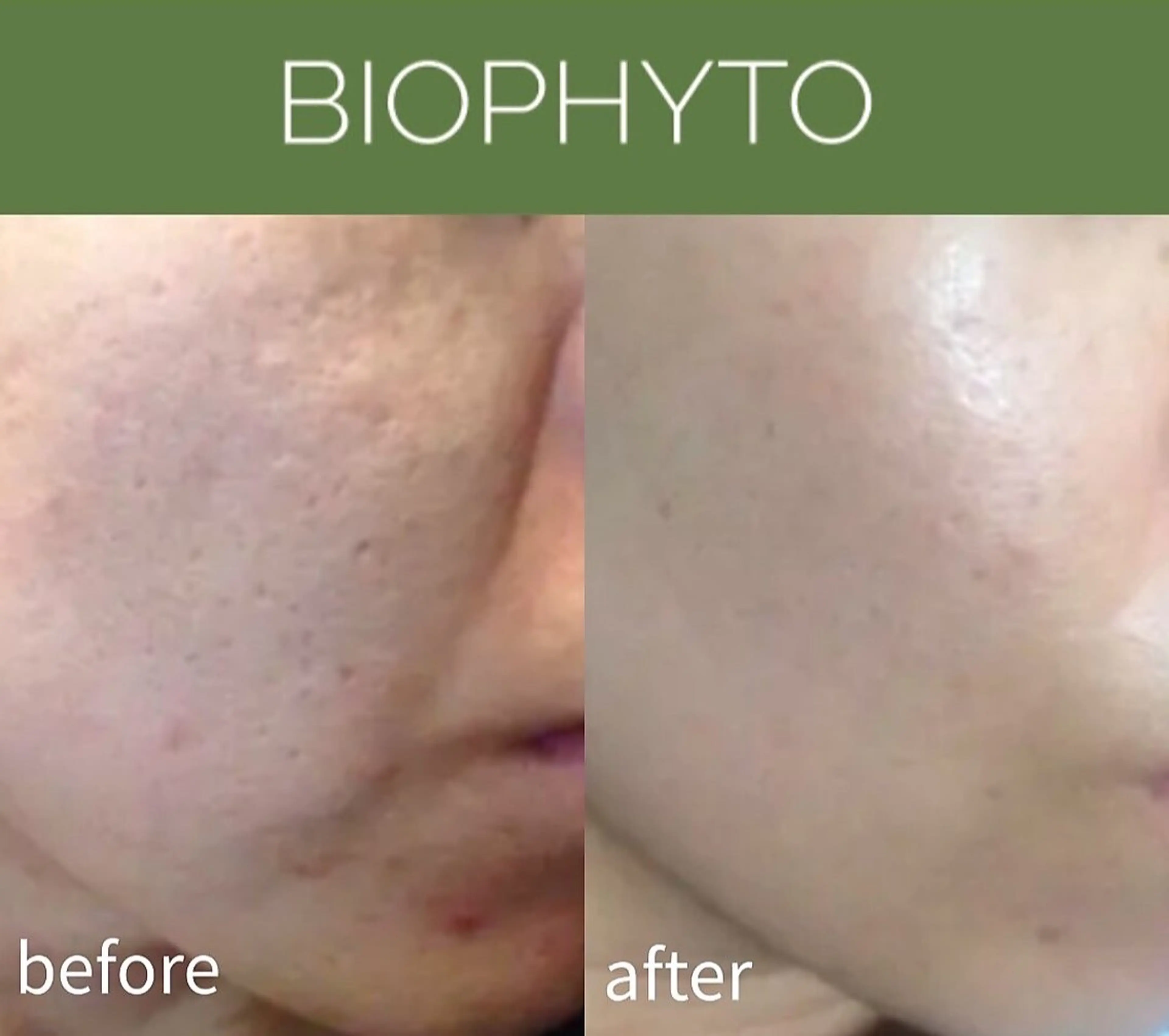 エステ DahliaBeauty ダリアビューティー所属・DahliaBeau tyフェイシャル中村のエステ・リラクイメージ