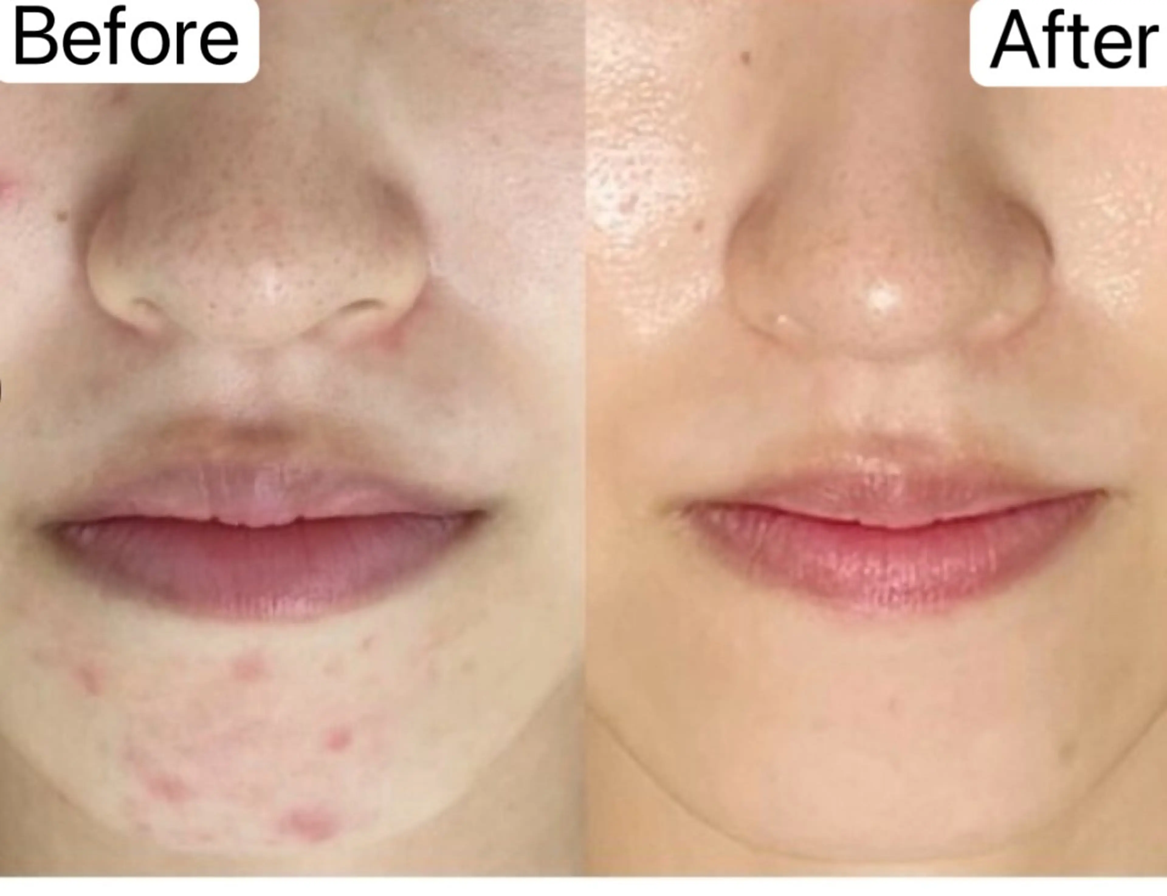 Belle原宿所属・佐藤 加奈のエステ・リラクイメージ