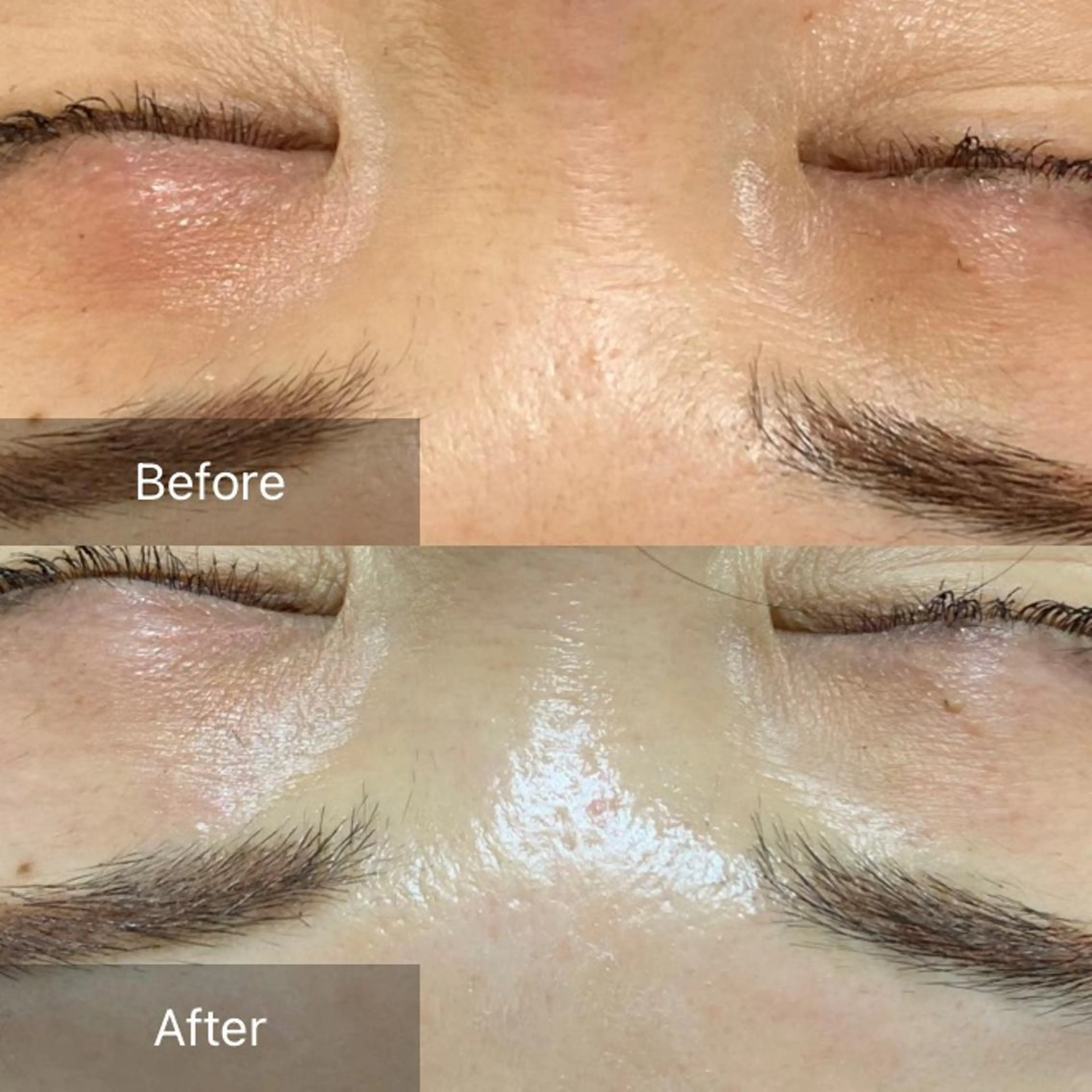 脱毛 産毛専門店 Bittoのエステ・リラクイメージ