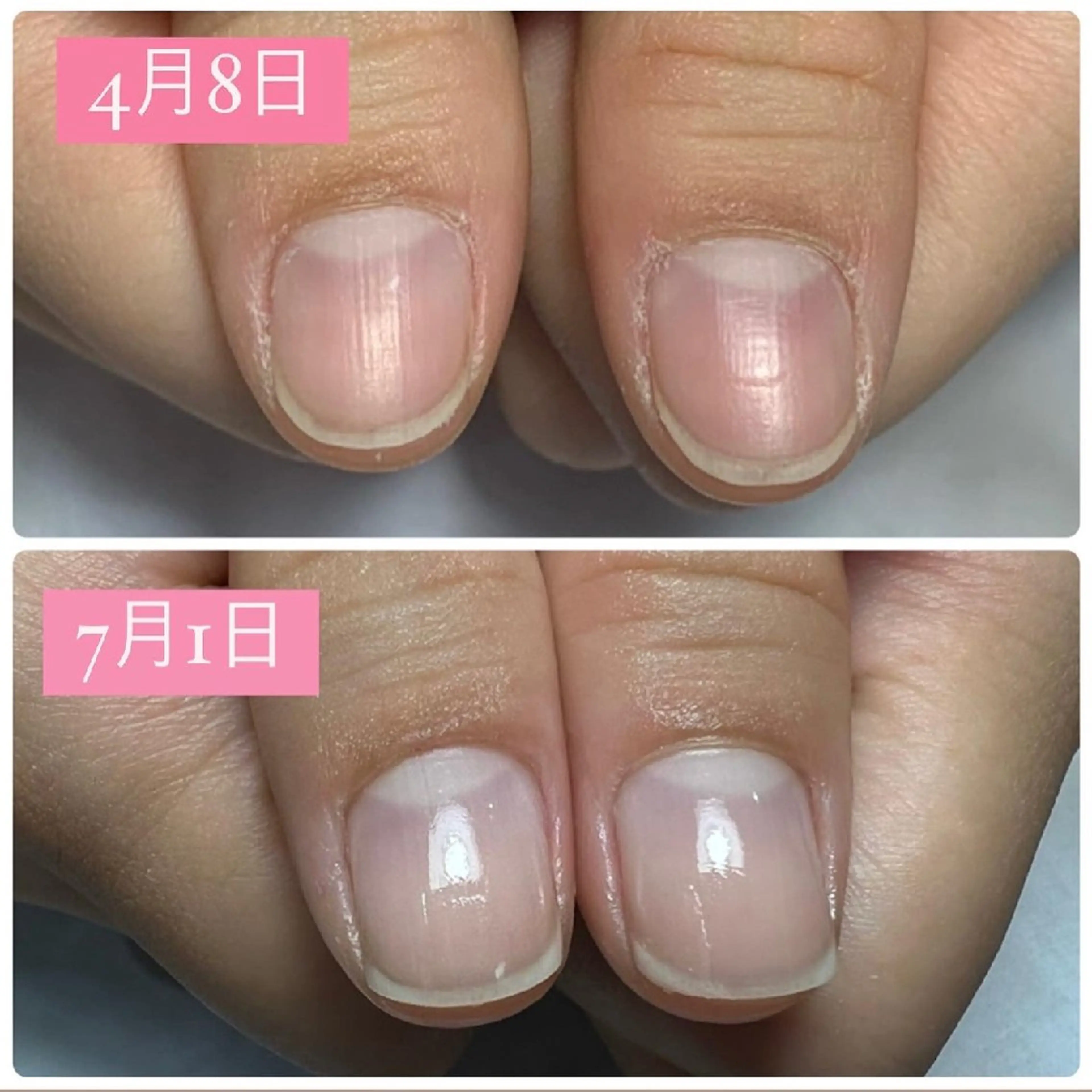 ネイル ジェルネイル ハンドケア AKT NAIL所属・AKT Beauty エステヘッドスパのエステ・リラクイメージ