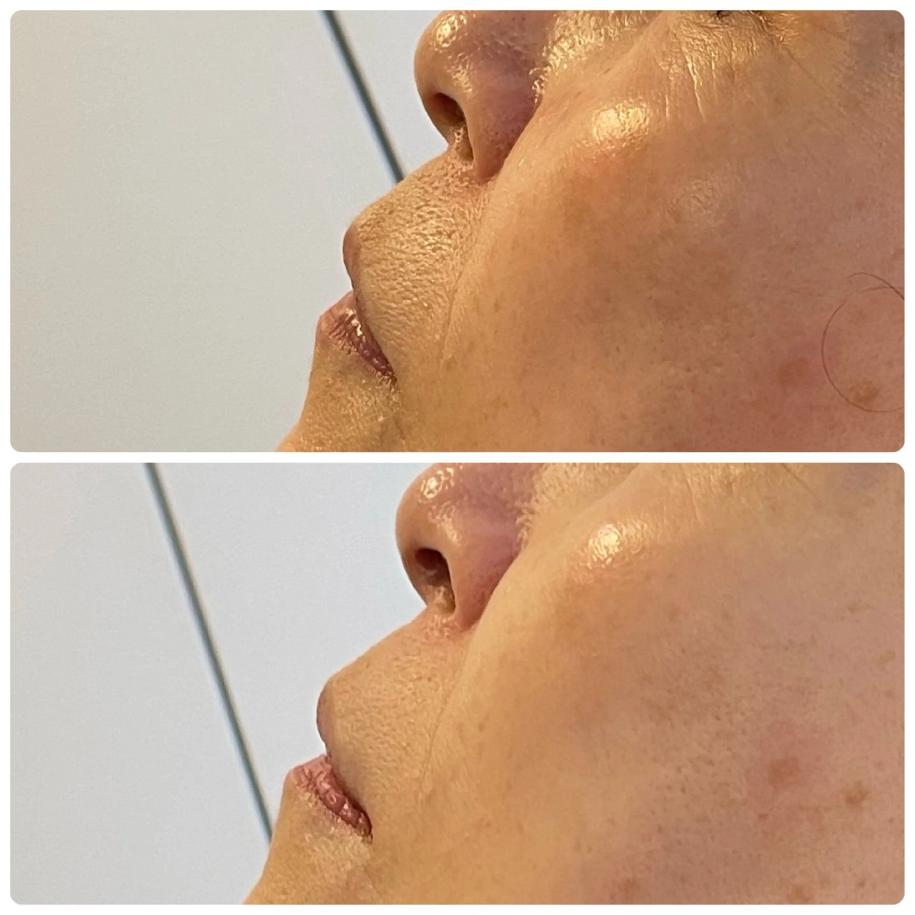 エステ リラク 小顔・たるみケア✨ フェイシャル&ボディのエステ・リラクイメージ