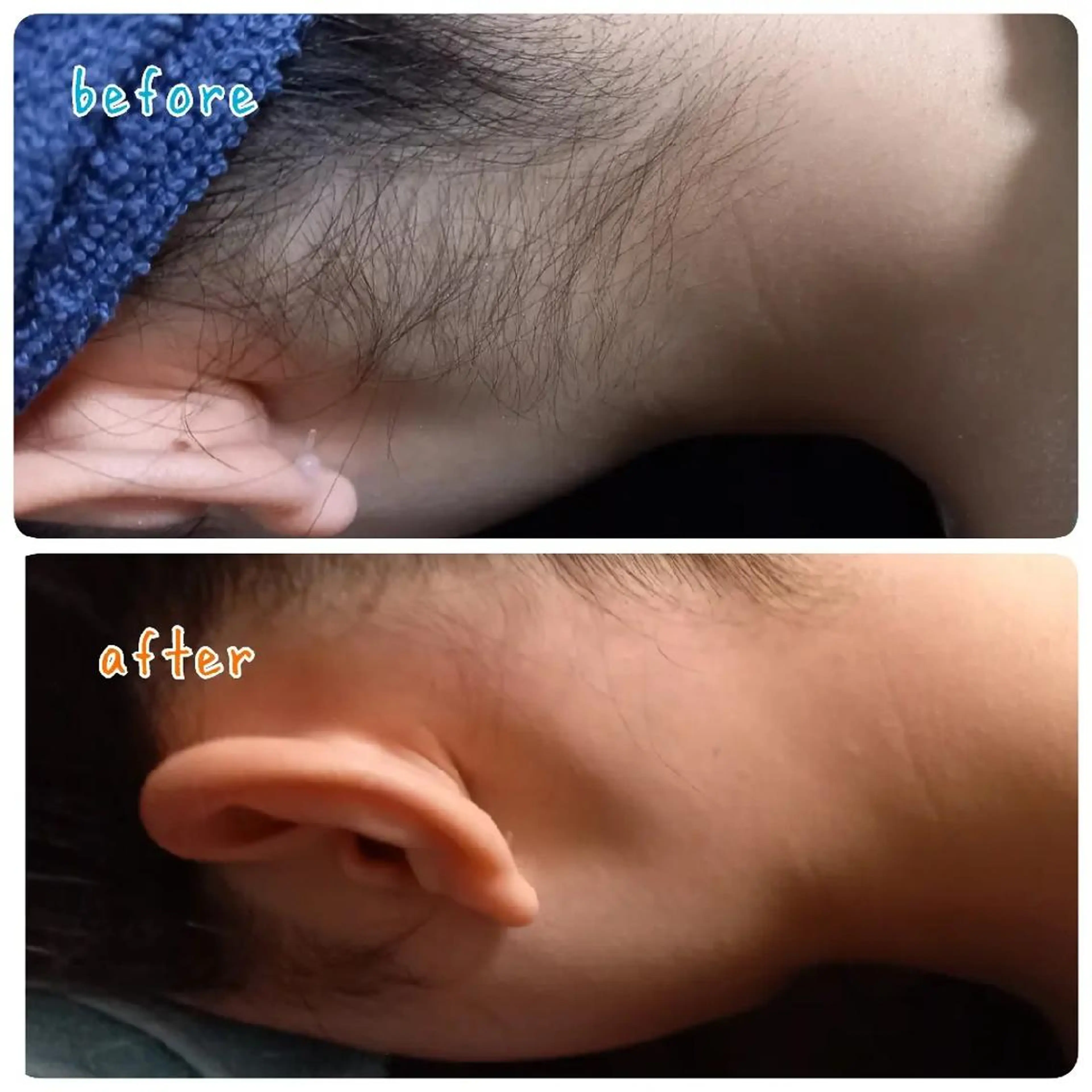 脱毛 sugaring wacca.のエステ・リラクイメージ