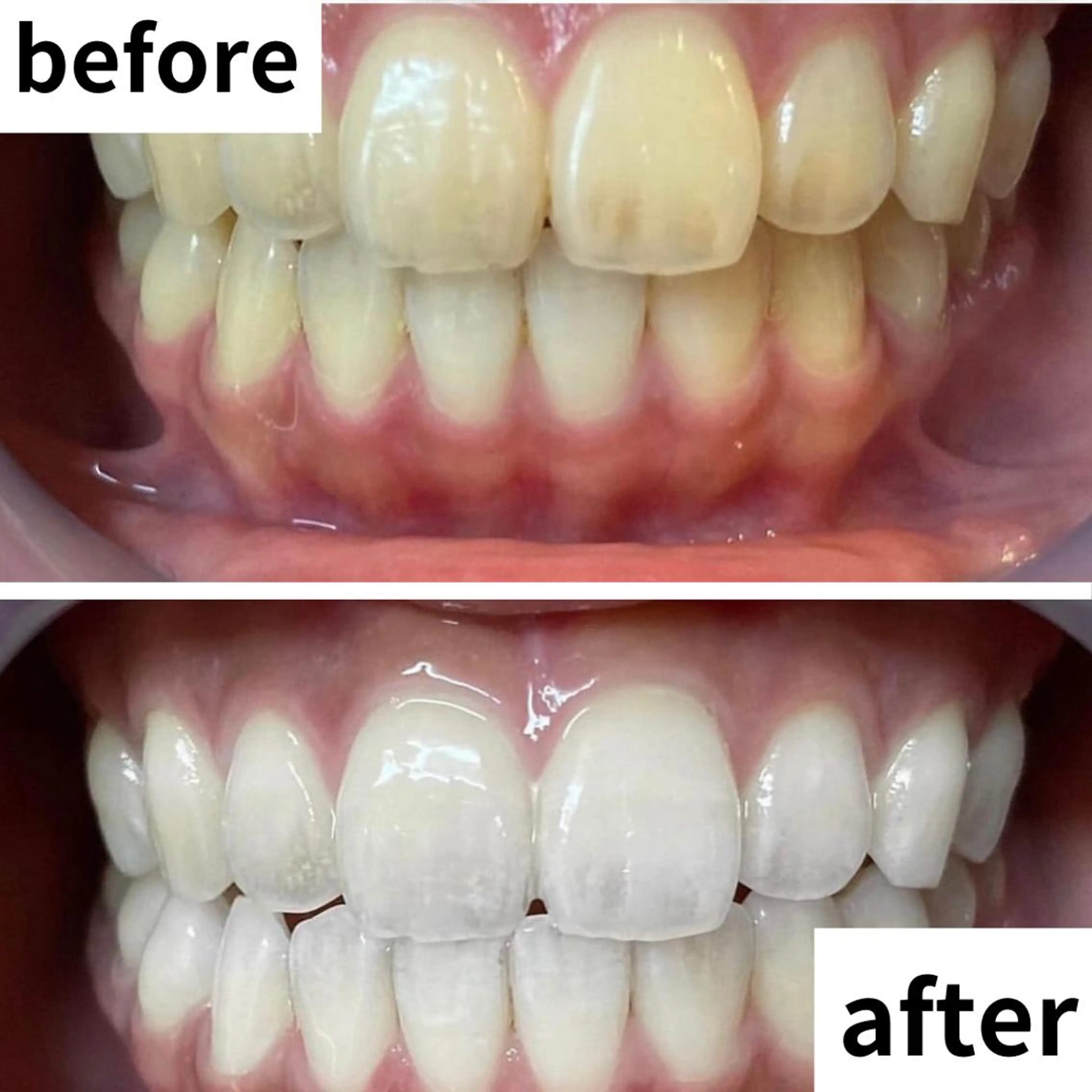 LBSホワイトニング 🌐渋谷店 河内のエステ・リラクイメージ