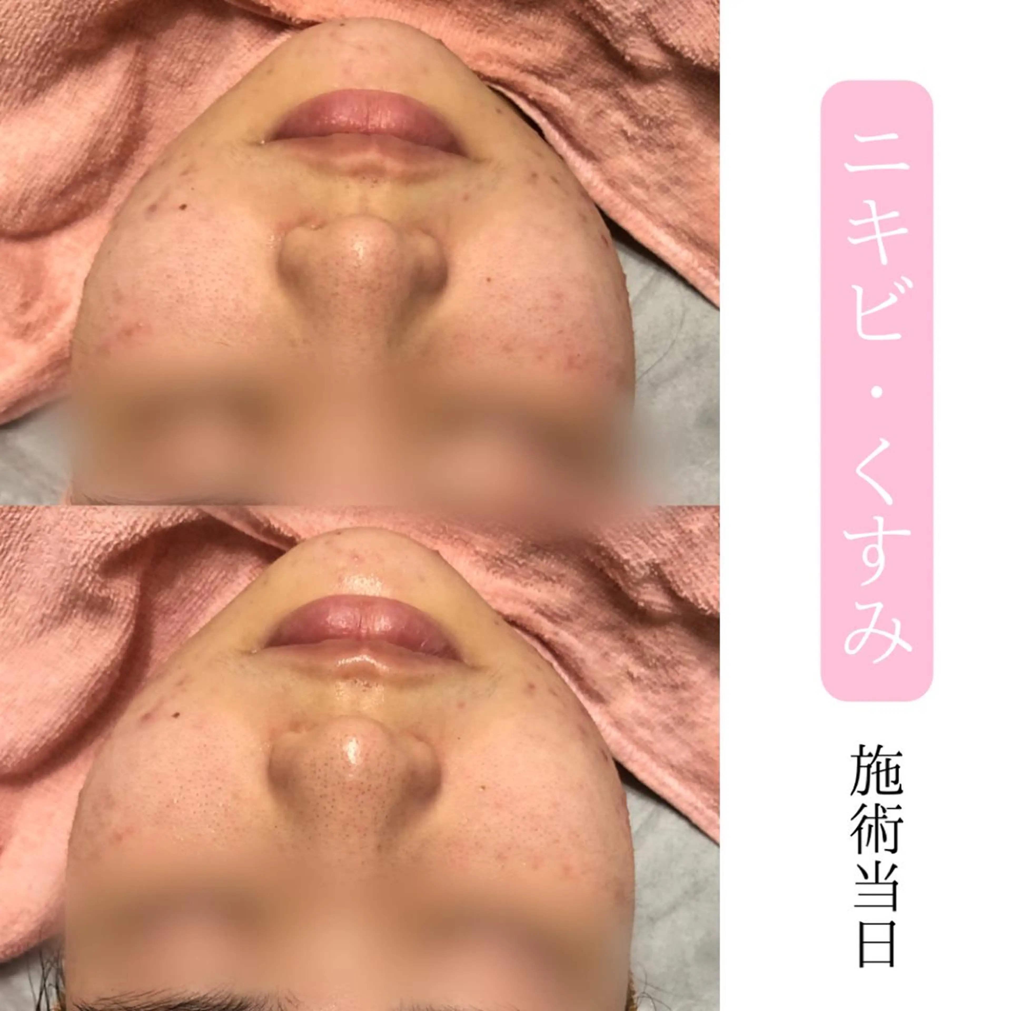 肌質改善サロン BestBelleのエステ・リラクイメージ