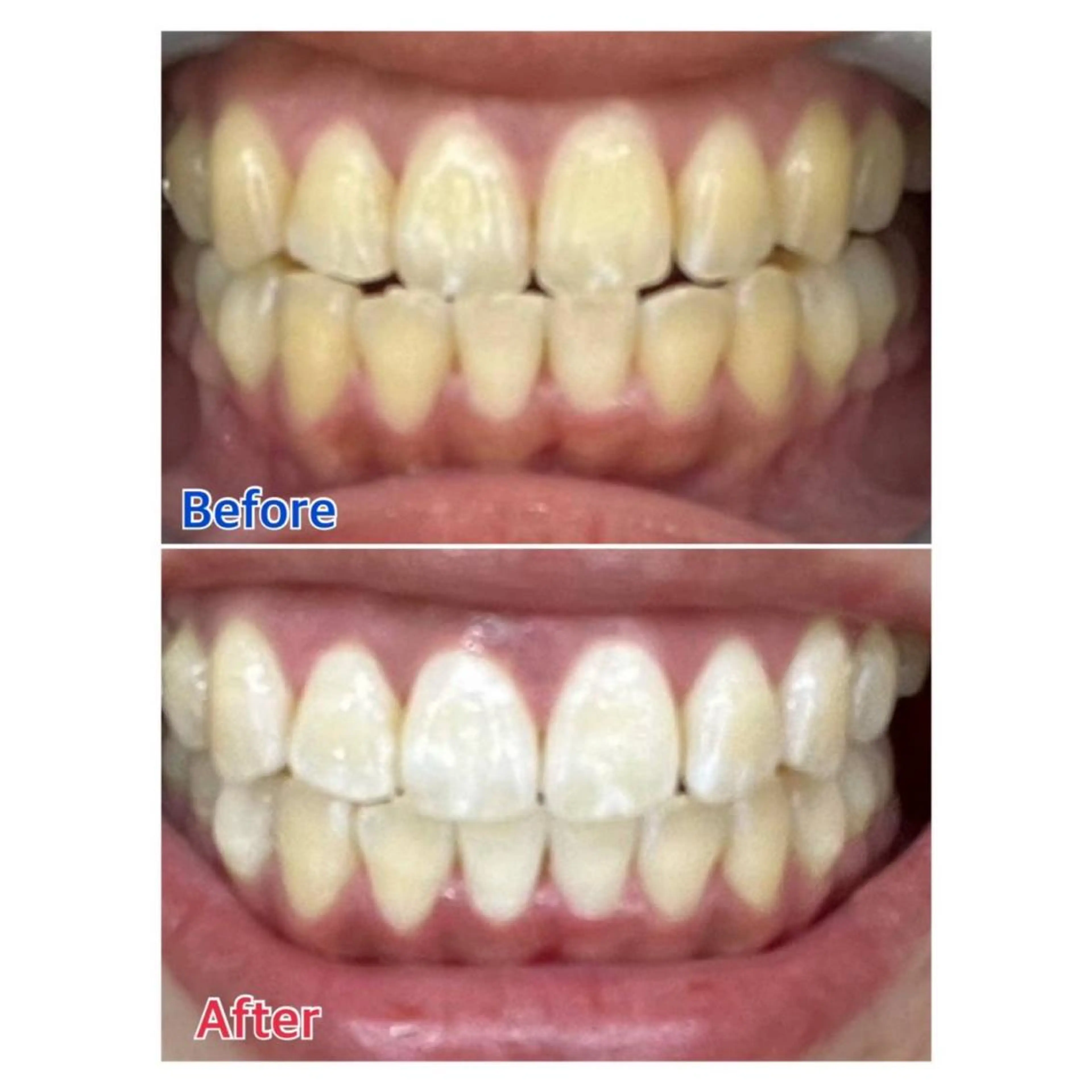 MBEAUTYSALON 千葉店・京成大久保所属・Melty 輝のその他イメージ